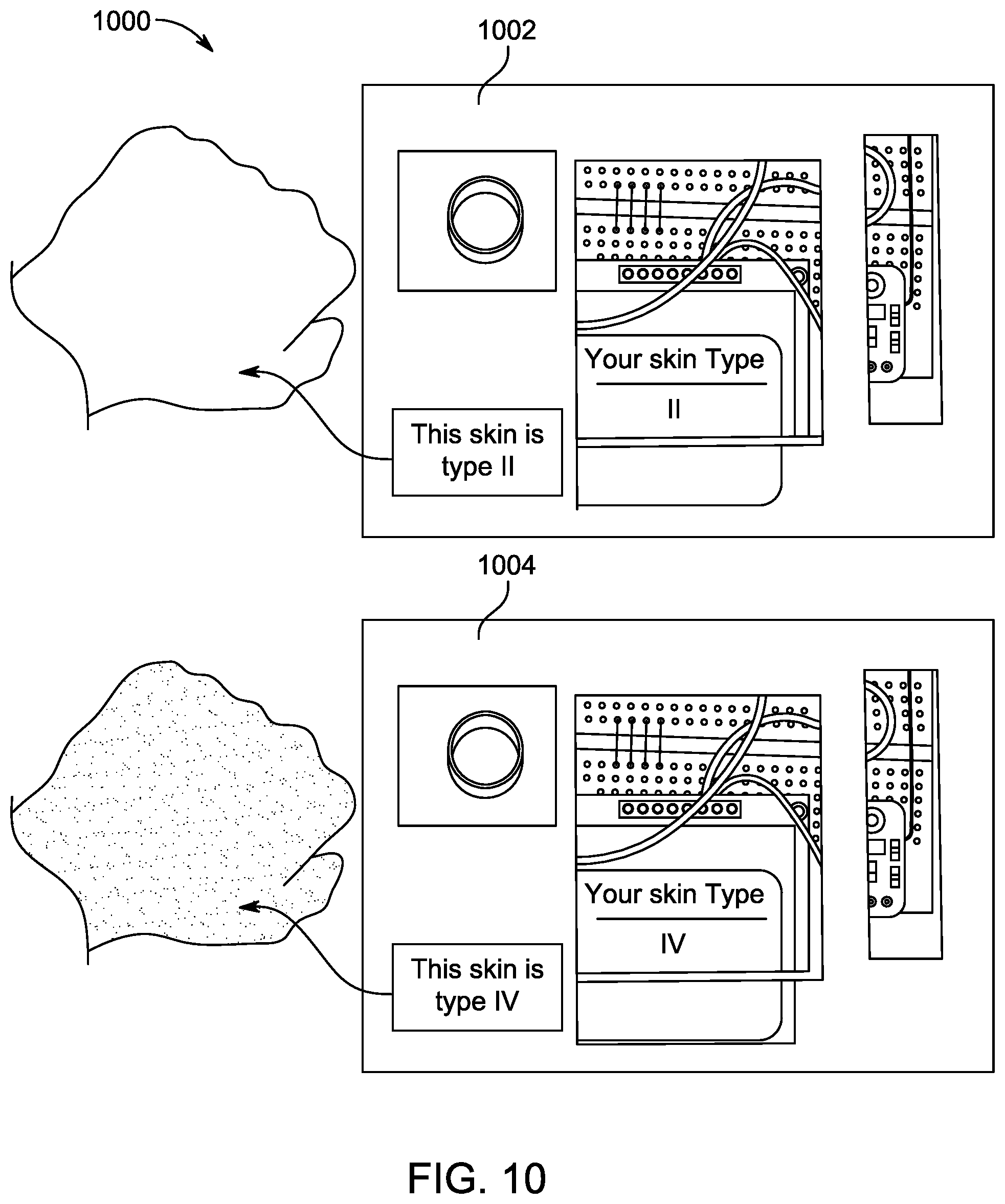 Patent US12313456 Figure 14 – Protective band to prevent skin damage to drivers