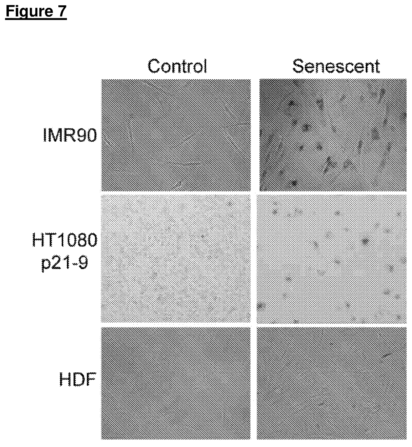 Patent US12313631 Figure 11 – Senescent cell biomarkers