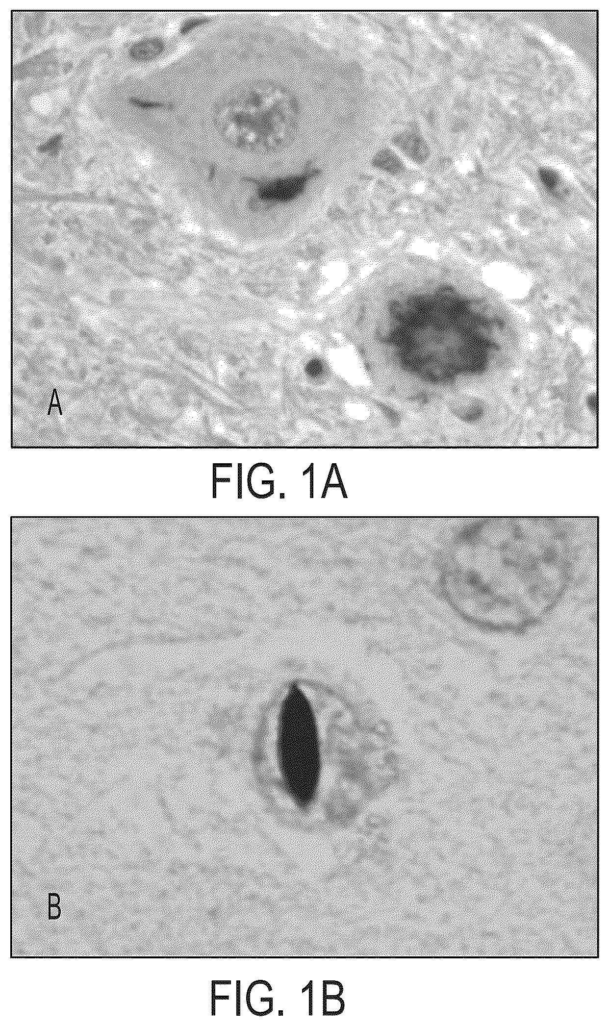 Patent US12313637 Figure 1 – Antibody based reagents that specifically recognize neurodegenerative disease related forms of the protein TDP-43