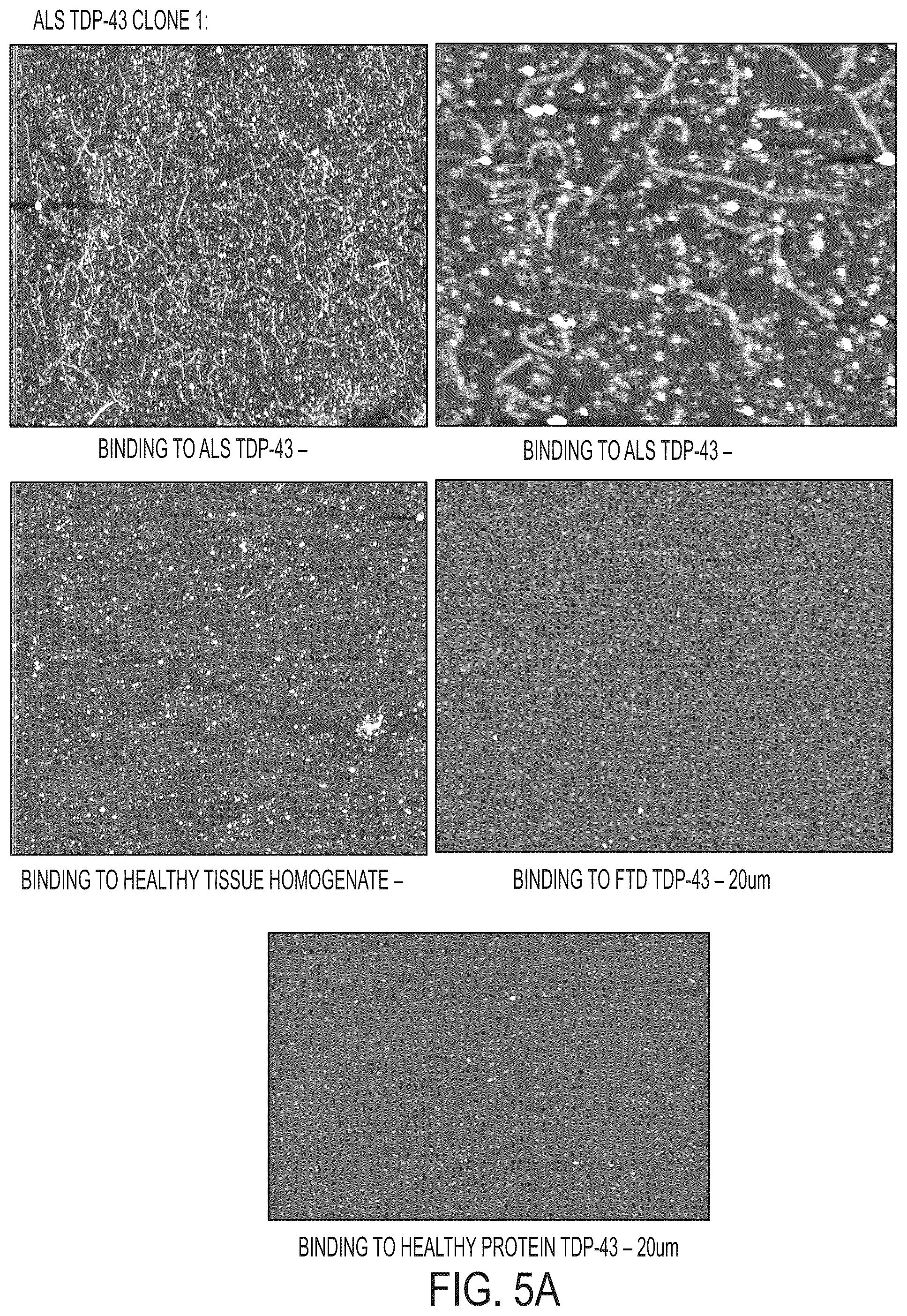 Patent US12313637 Figure 8 – Antibody based reagents that specifically recognize neurodegenerative disease related forms of the protein TDP-43