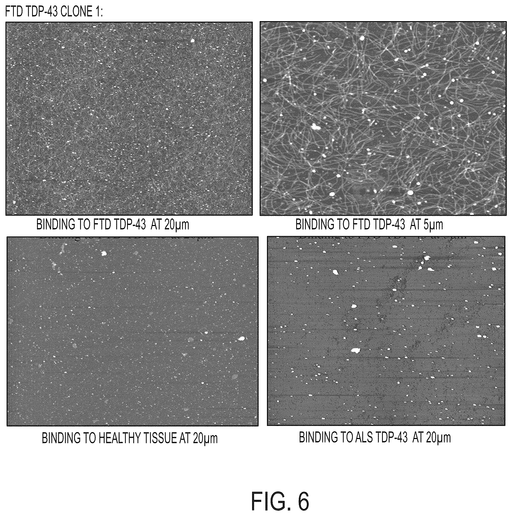 Patent US12313637 Figure 11 – Antibody based reagents that specifically recognize neurodegenerative disease related forms of the protein TDP-43