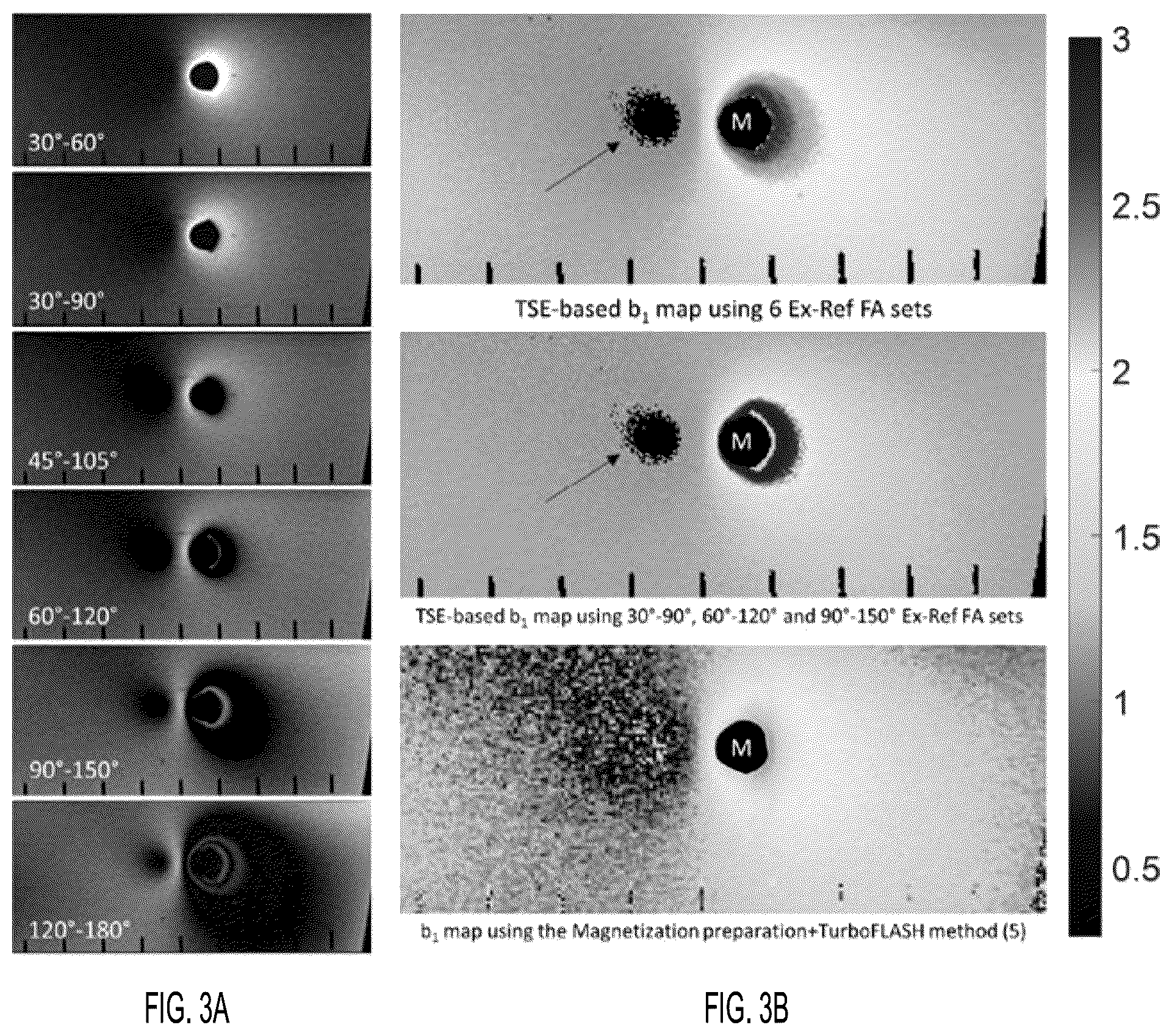 Patent US12313710 Figure 3 – B1+ mapping near metallic hardware