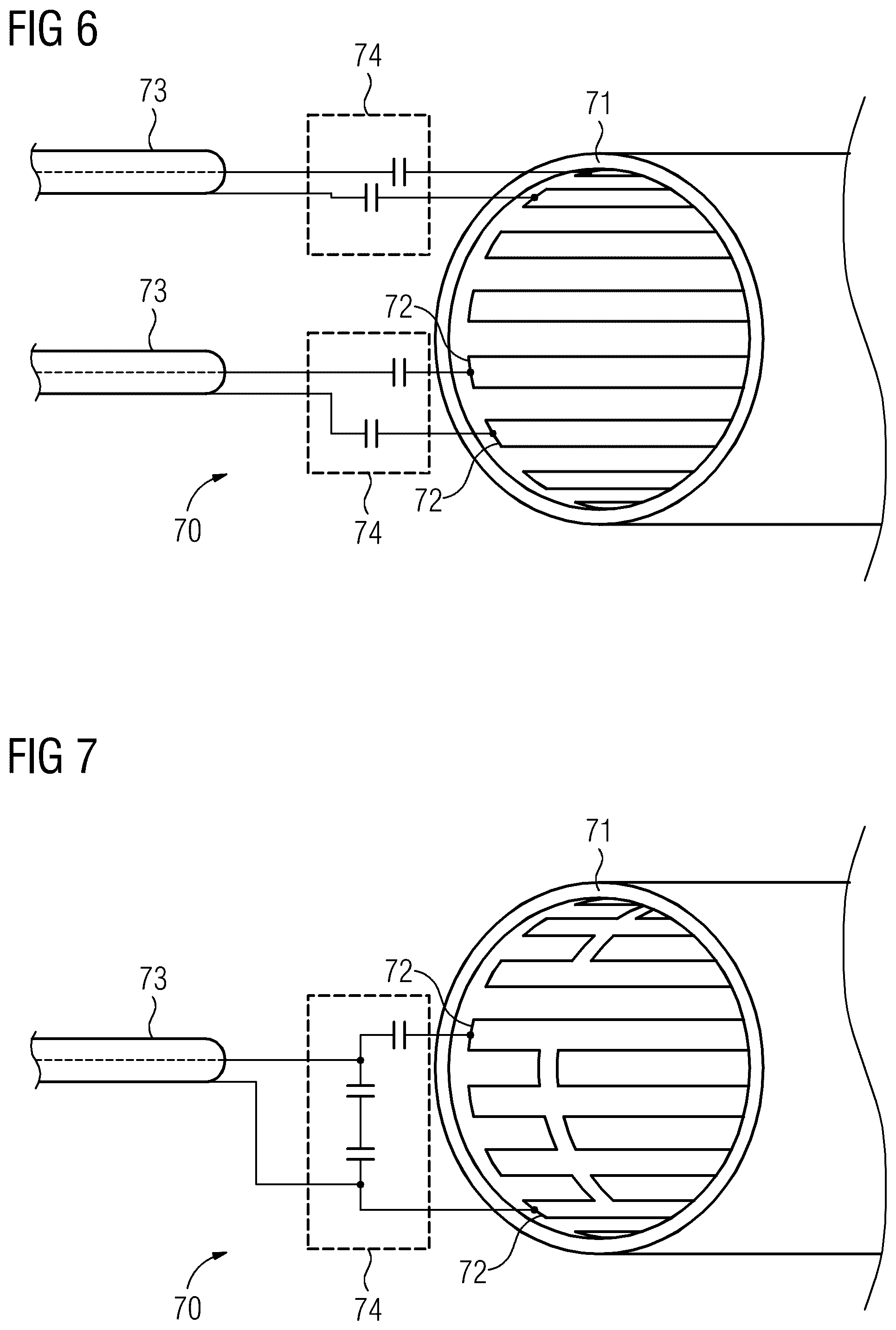 Patent US12313712 Figure 4 – Sensor for detecting gradient-bounded interference to a magnetic resonance tomography system and method for operation