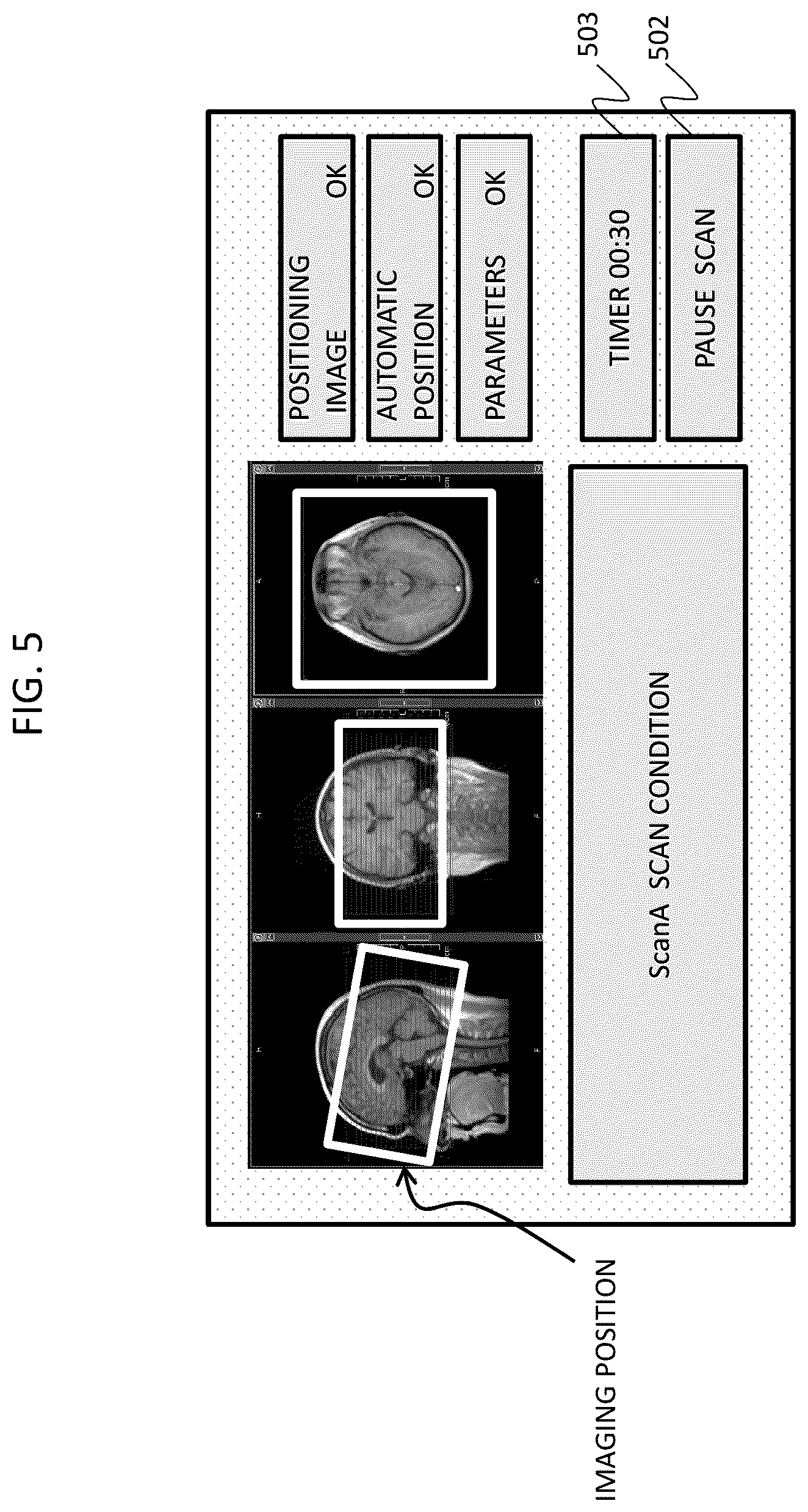 Patent US12313715 Figure 5 – Magnetic resonance imaging apparatus and control program for magnetic resonance imaging apparatus