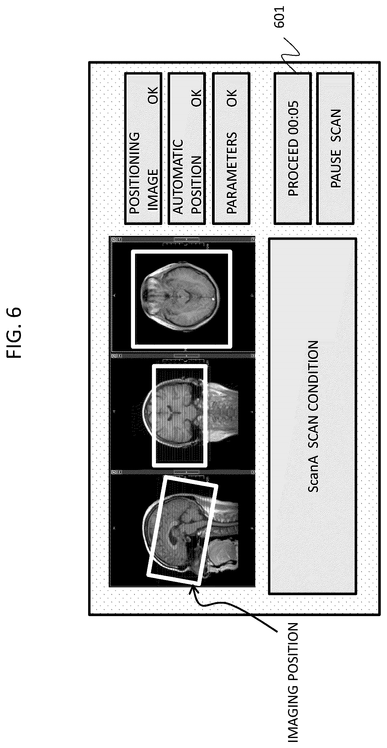 Patent US12313715 Figure 6 – Magnetic resonance imaging apparatus and control program for magnetic resonance imaging apparatus