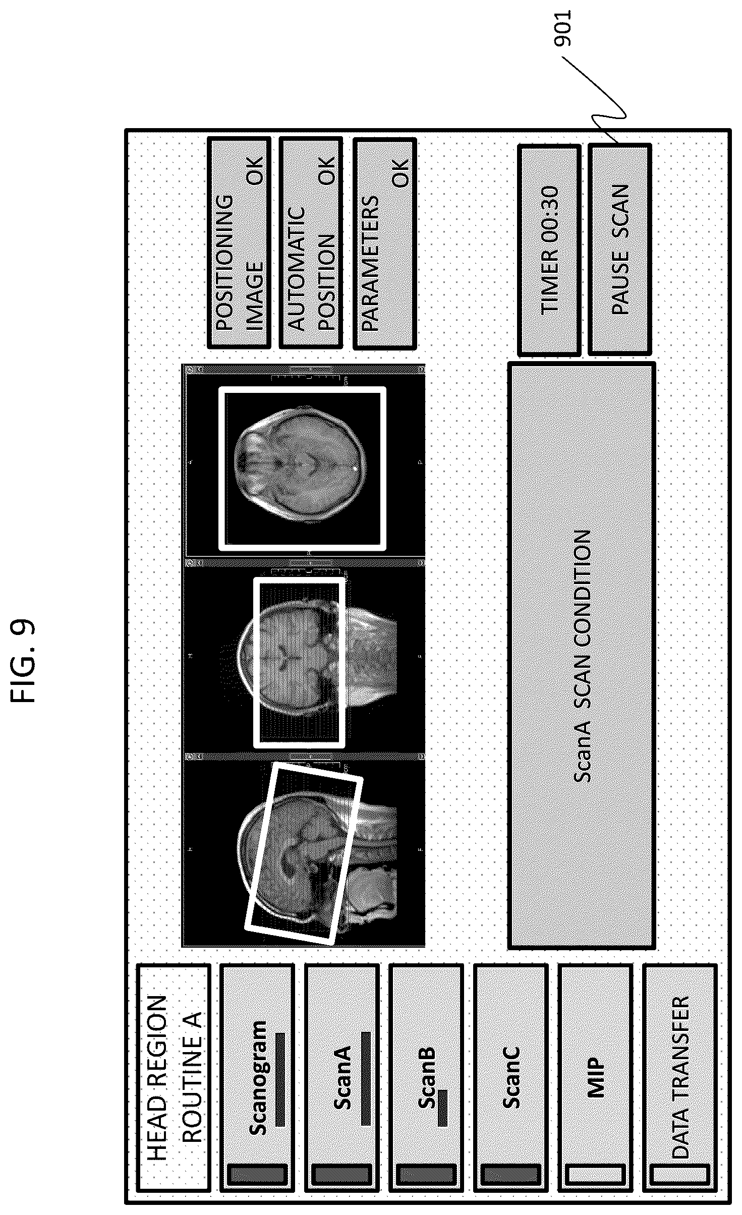 Patent US12313715 Figure 9 – Magnetic resonance imaging apparatus and control program for magnetic resonance imaging apparatus