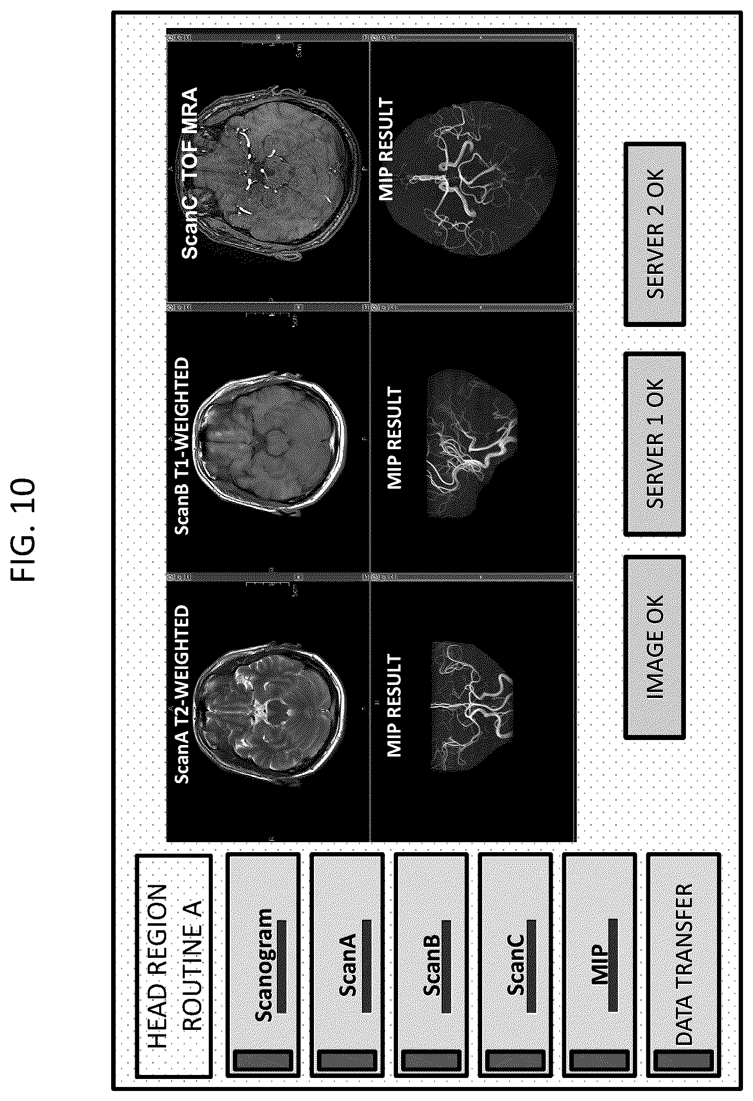 Patent US12313715 Figure 10 – Magnetic resonance imaging apparatus and control program for magnetic resonance imaging apparatus