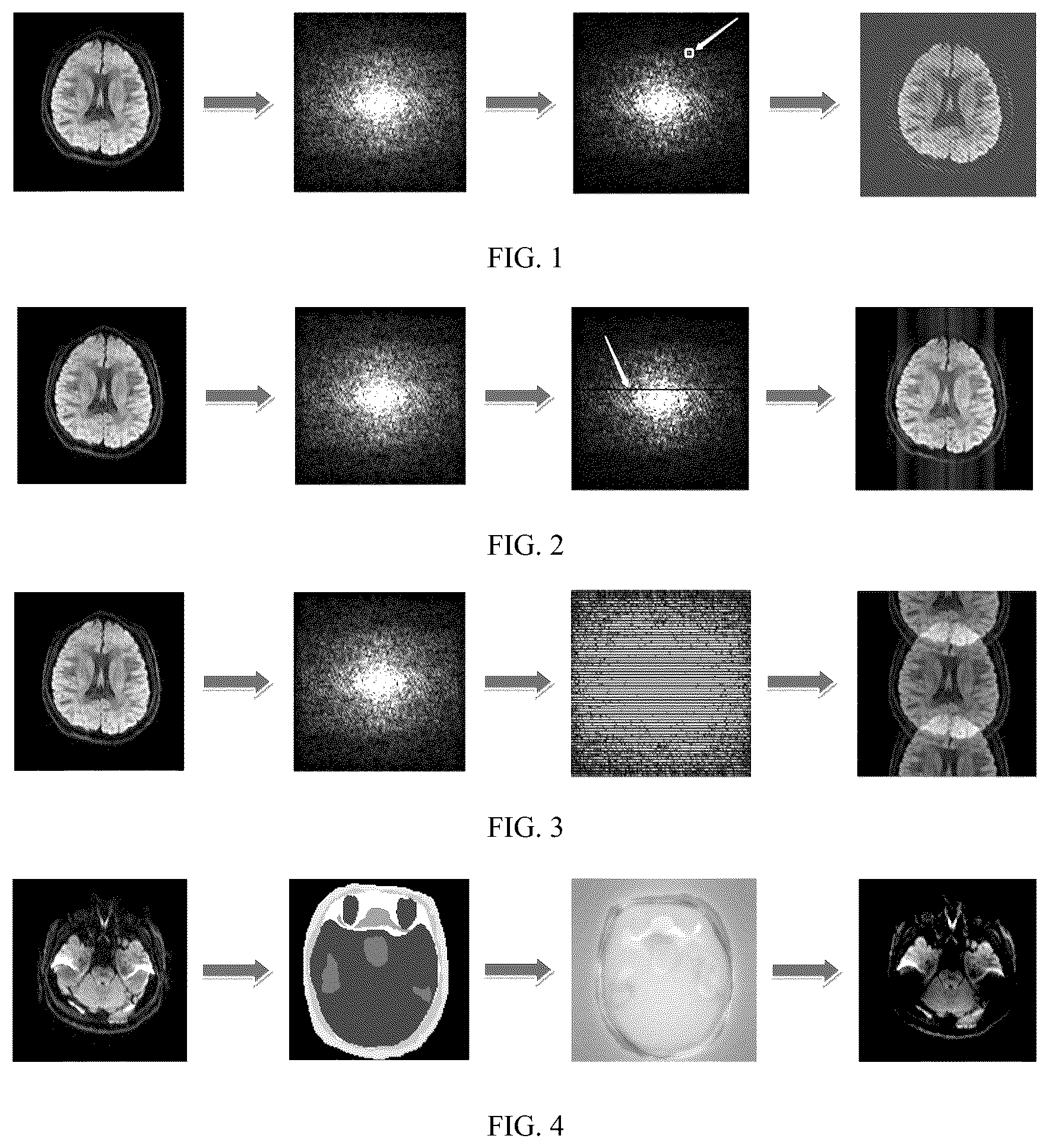 Patent US12313716 Figure 1 – Method and system for simulating magnetic resonance echo-planar imaging artifact