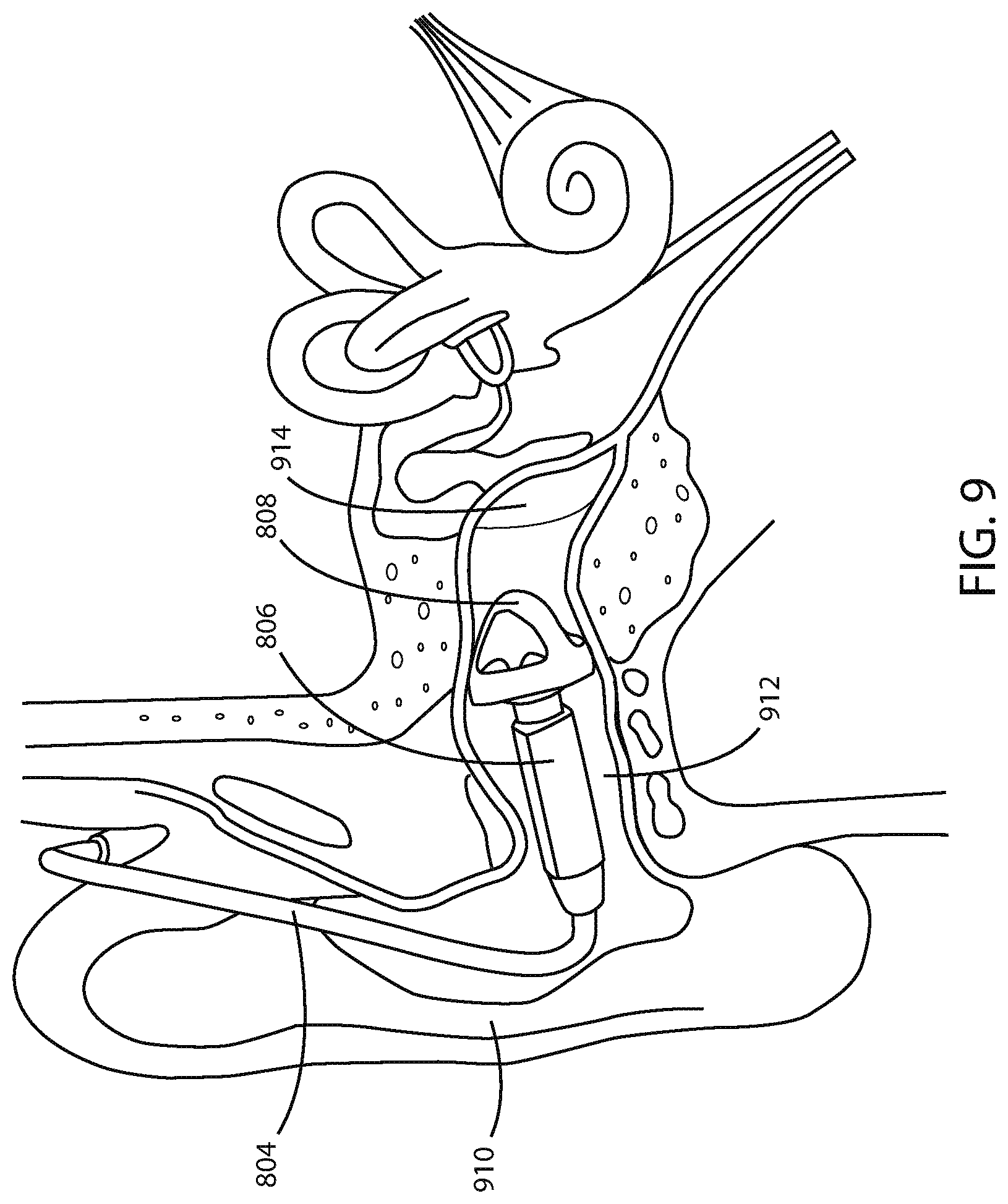 Patent US12313762 Figure 9 – Systems and methods for locating mobile electronic devices with ear-worn devices