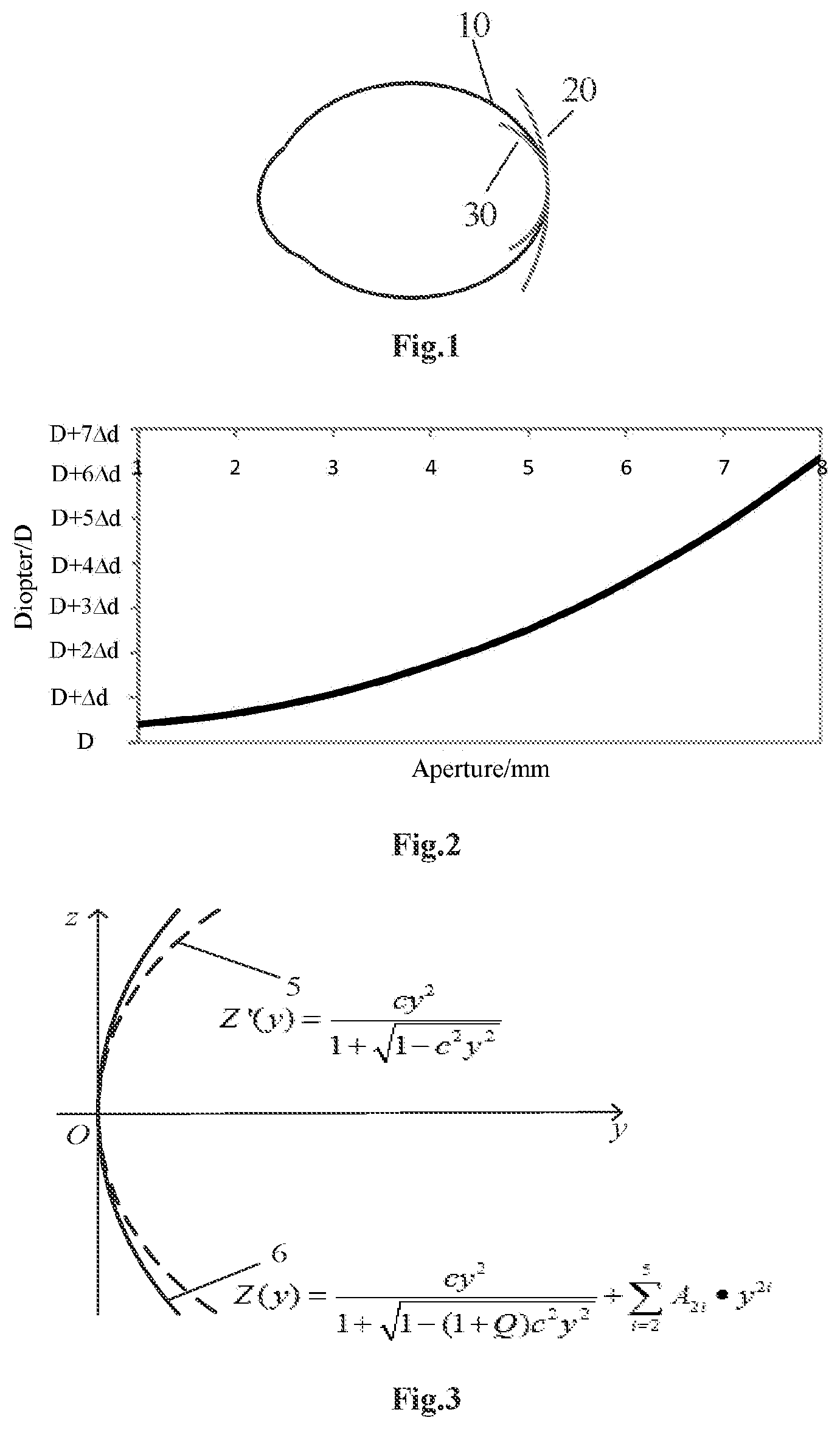 Patent US12313918 Figure 1 – Vision correction lens and method for preparation of the same
