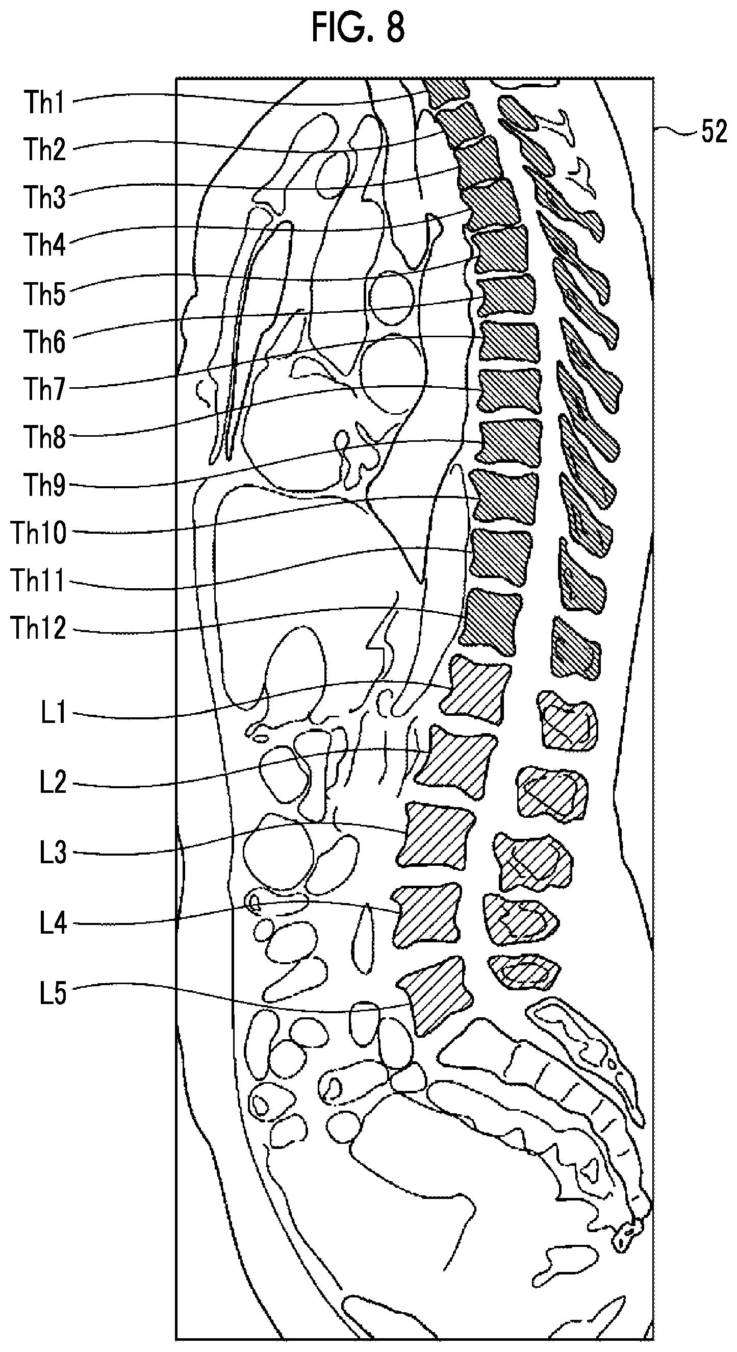 Patent US12314345 Figure 7 – Learning apparatus, learning method, and learning program, class classification apparatus, class classification method, and class classification program, and learned model