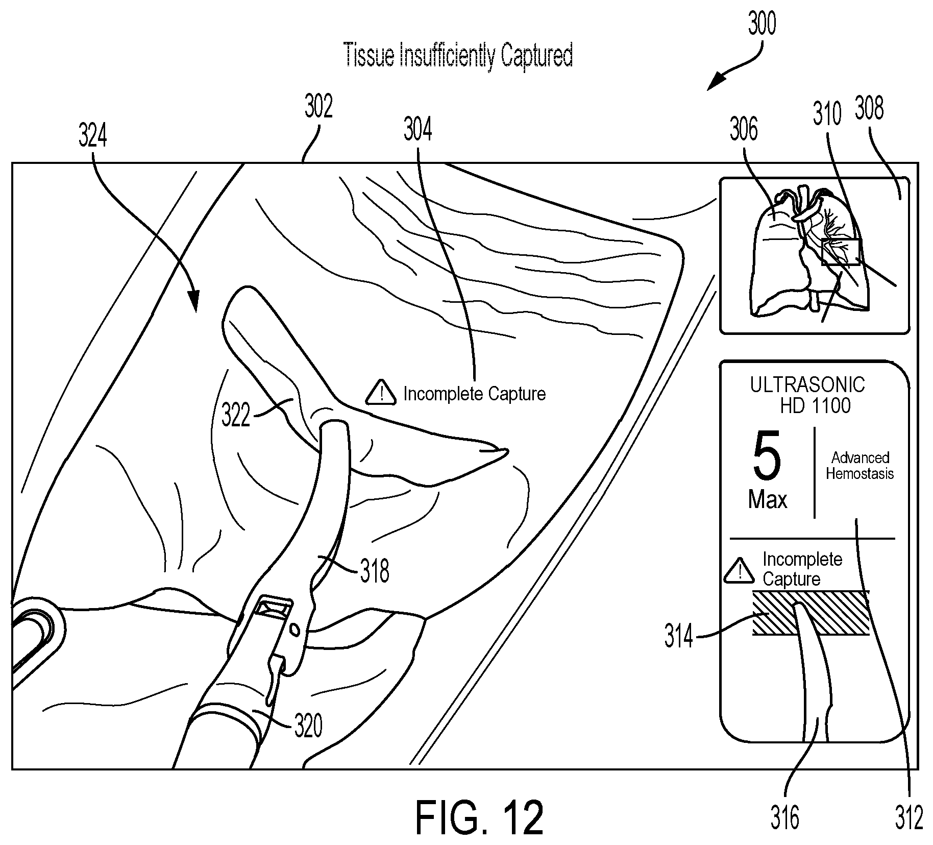 Patent US12315036 Figure 12 – Mixed reality feedback systems that cooperate to increase efficient perception of complex data feeds