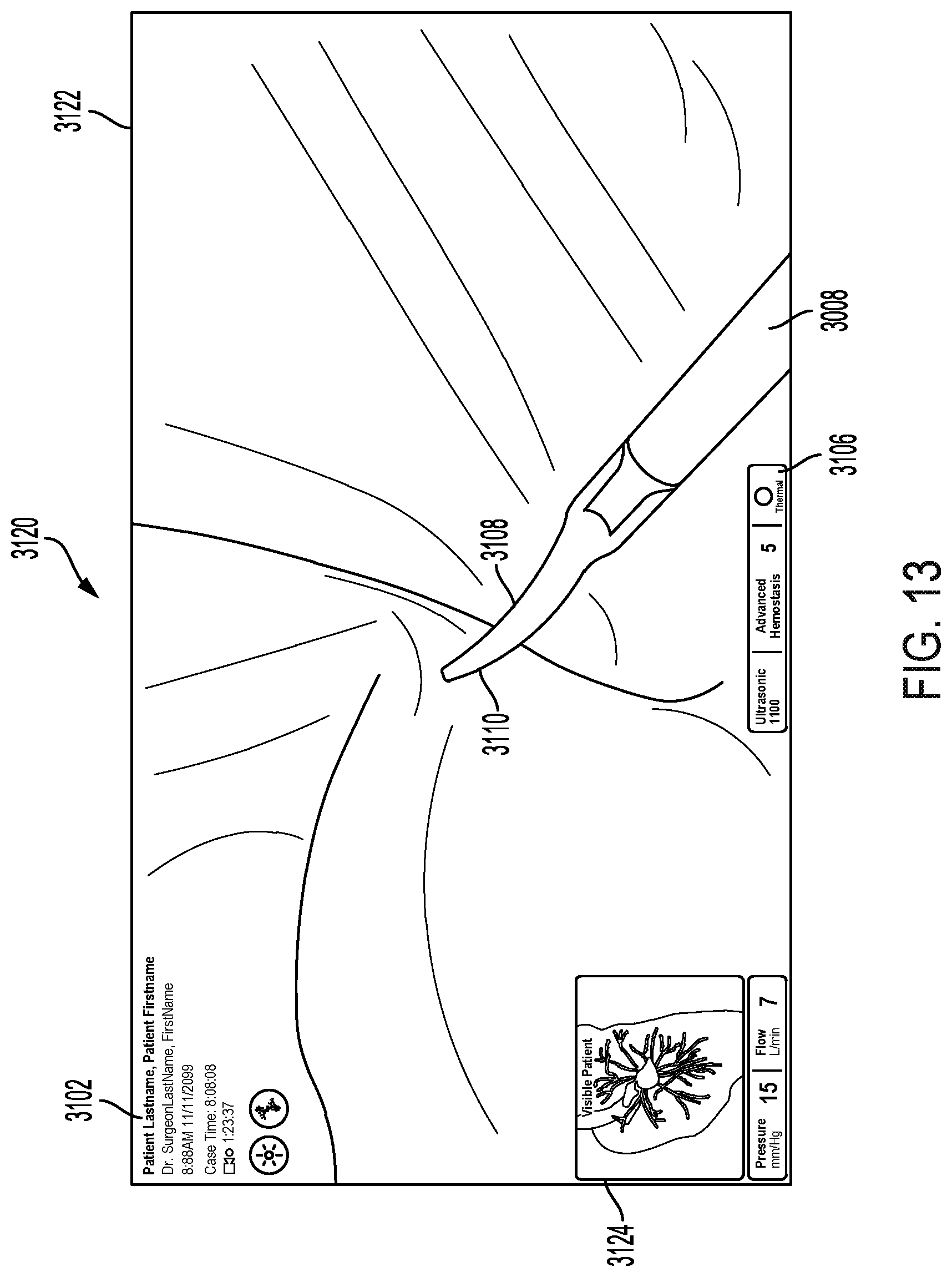 Patent US12315036 Figure 13 – Mixed reality feedback systems that cooperate to increase efficient perception of complex data feeds