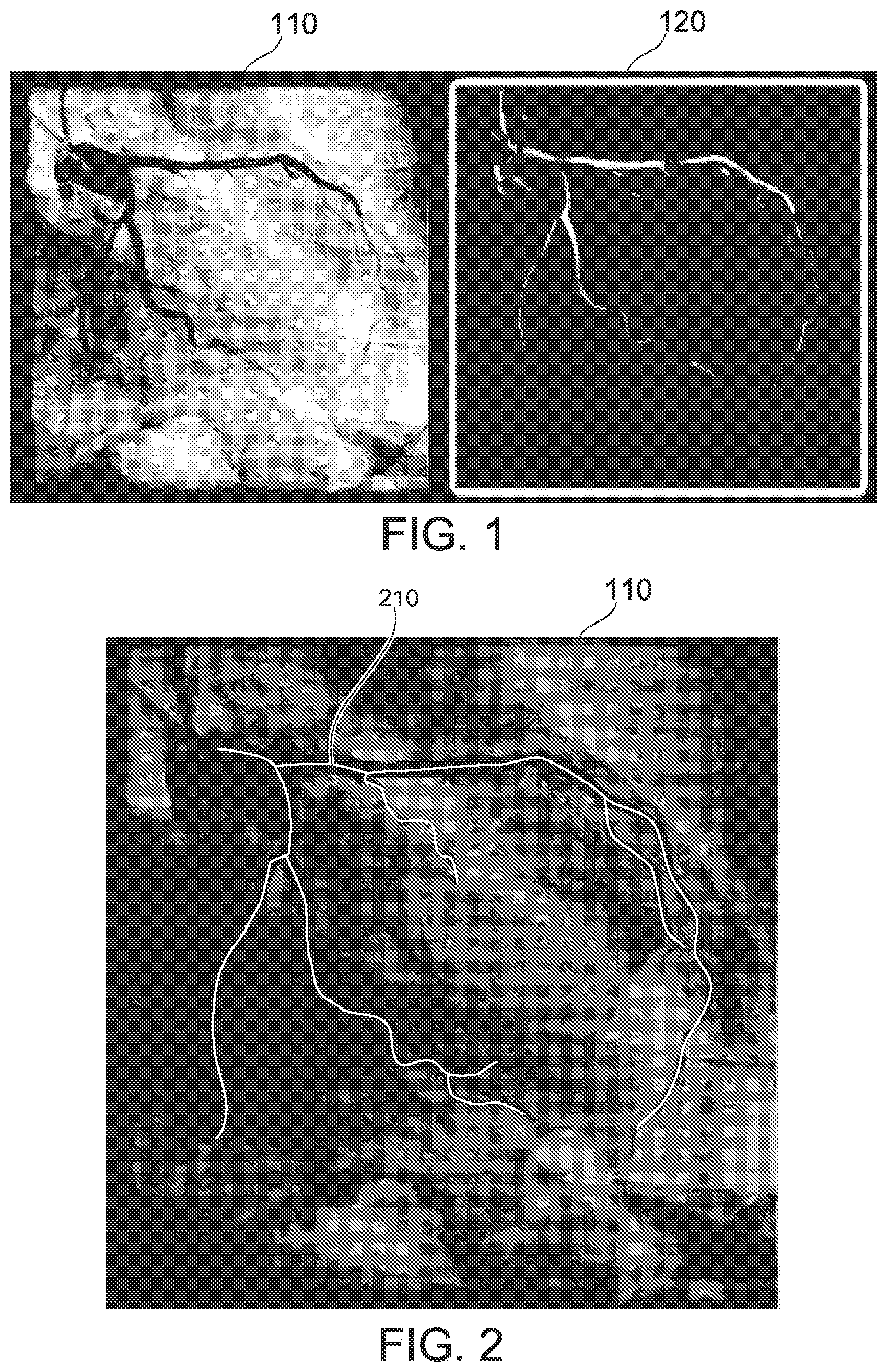 Patent US12315076 Figure 1 – Four-dimensional motion analysis of a patient's coronary arteries and myocardial wall