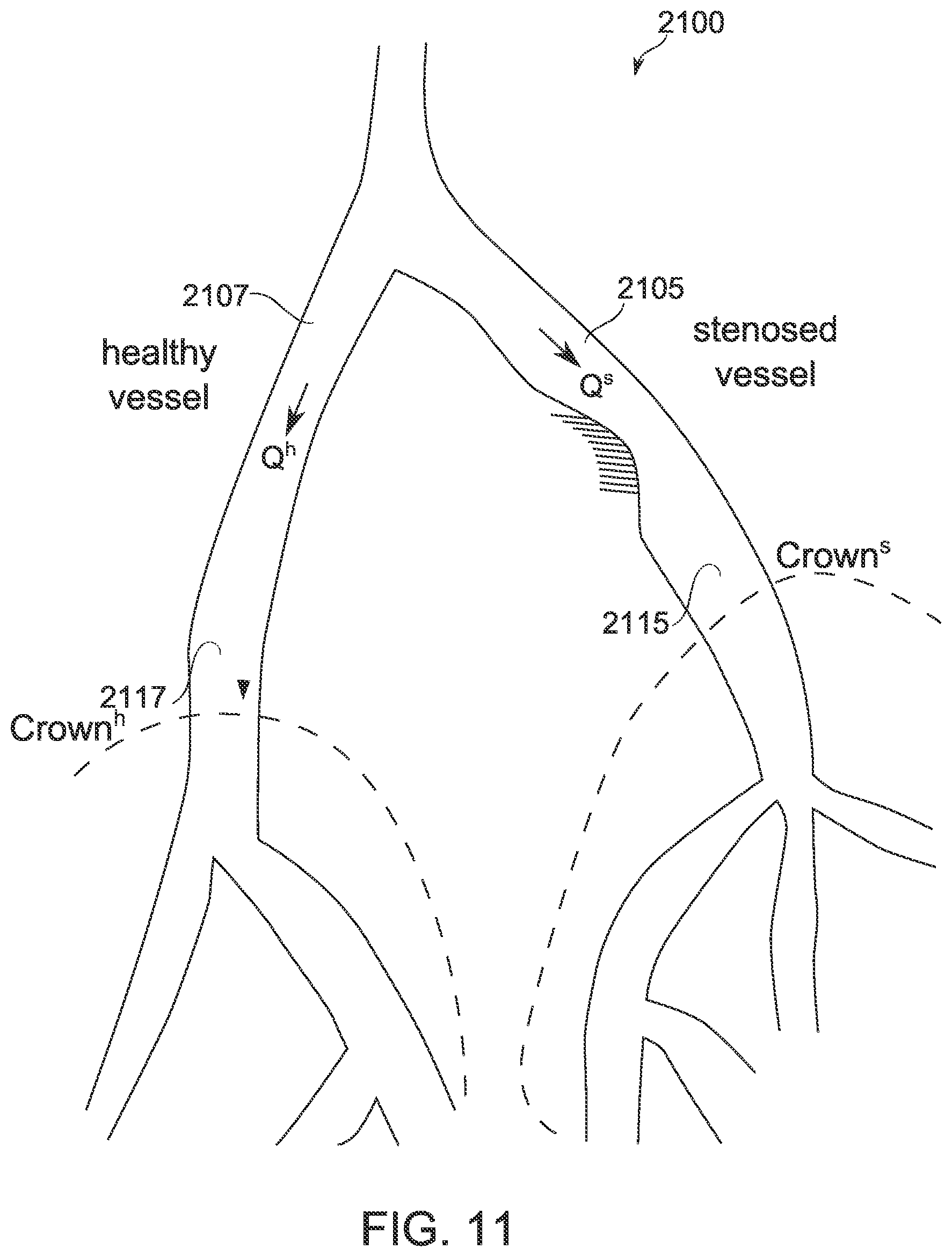 Patent US12315076 Figure 8 – Four-dimensional motion analysis of a patient's coronary arteries and myocardial wall