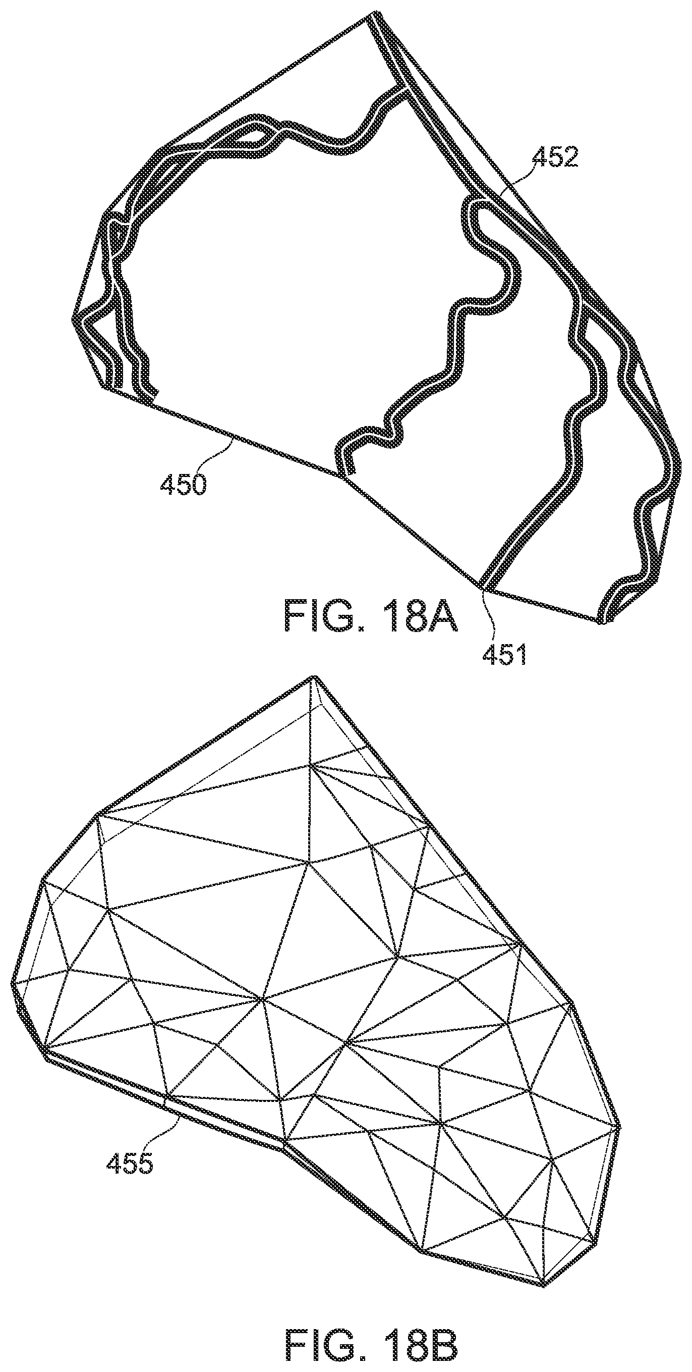 Patent US12315076 Figure 17 – Four-dimensional motion analysis of a patient's coronary arteries and myocardial wall
