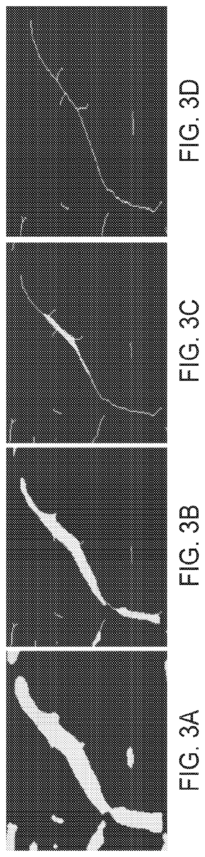 Patent US12315141 Figure 3 – Systems and methods for quantifying vessel features in ultrasound doppler images