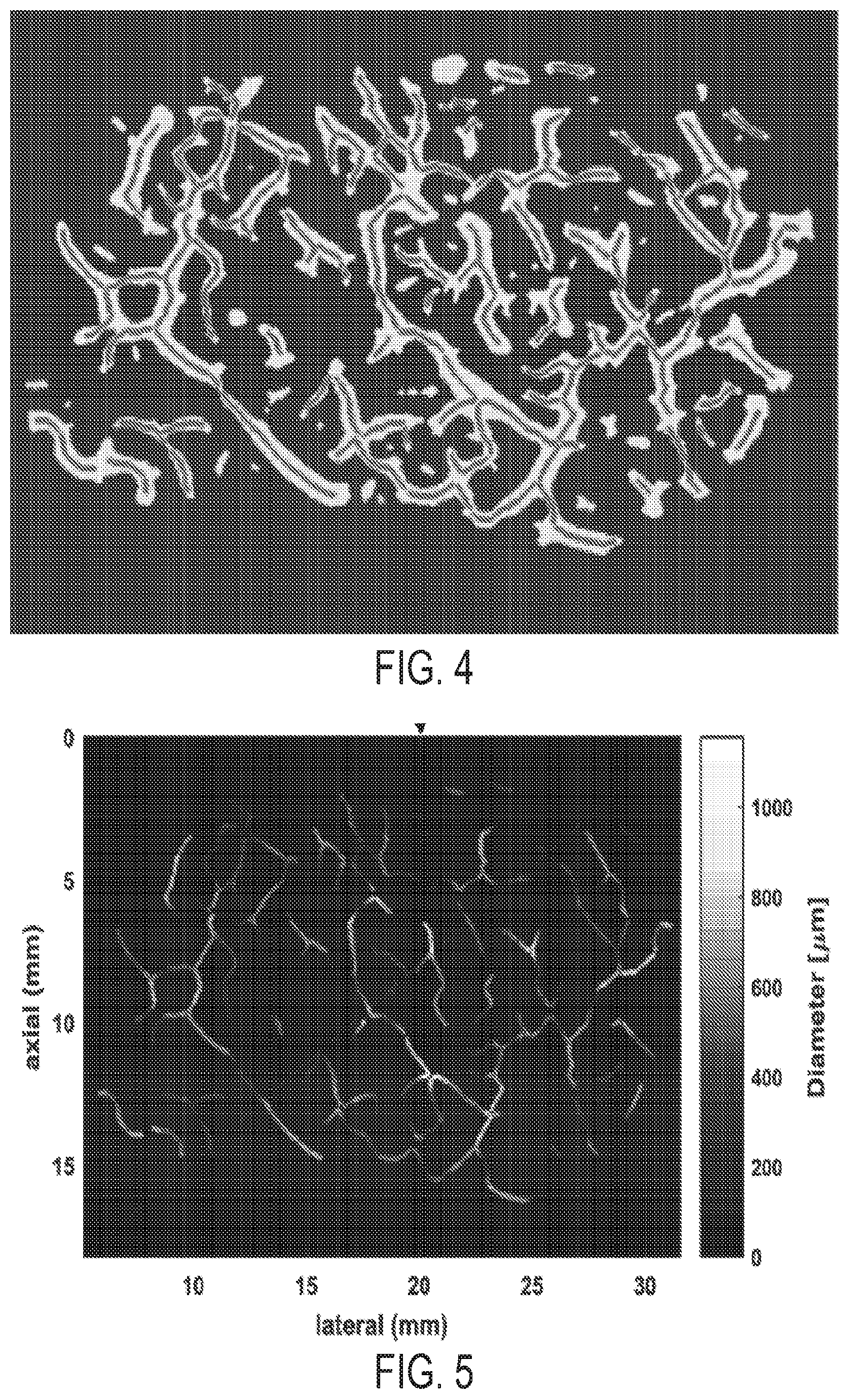 Patent US12315141 Figure 4 – Systems and methods for quantifying vessel features in ultrasound doppler images