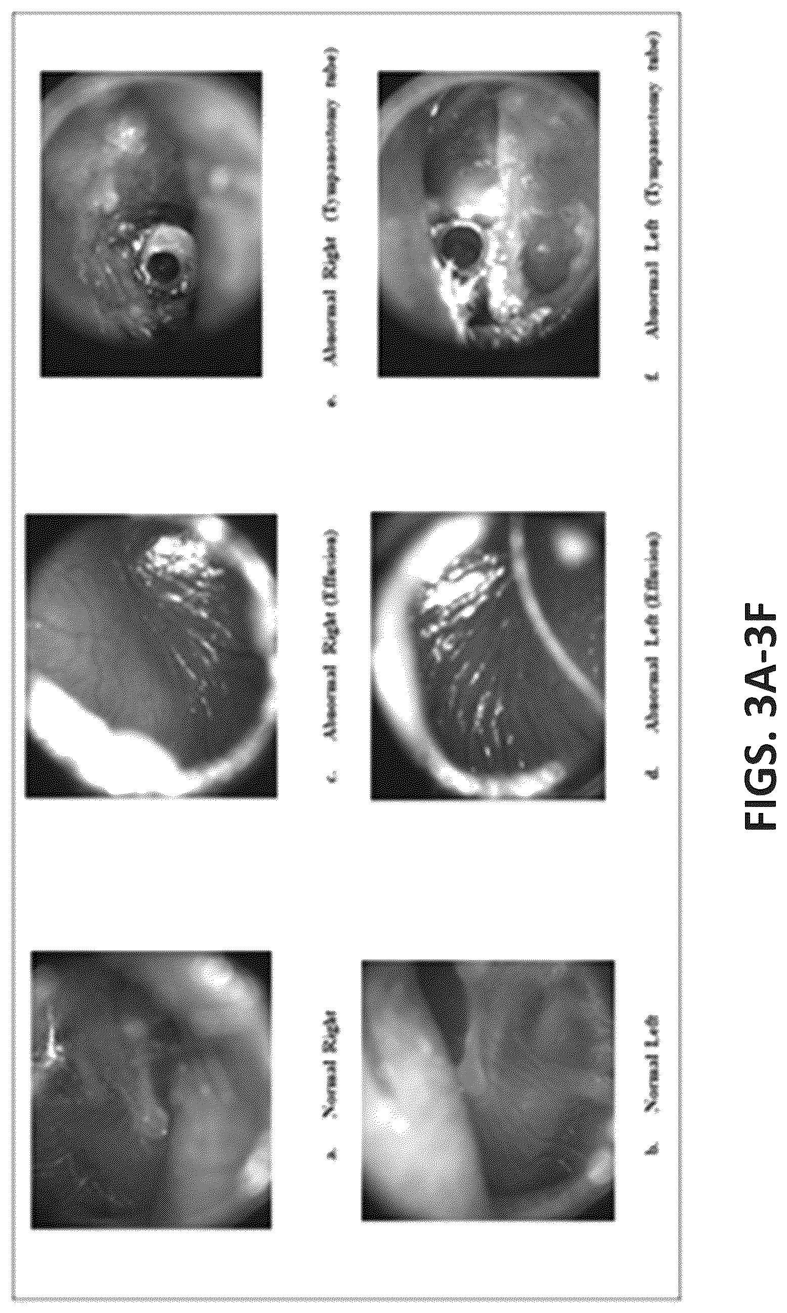 Patent US12315143 Figure 4 – System and method of using right and left eardrum otoscopy images for automated otoscopy image analysis to diagnose ear pathology