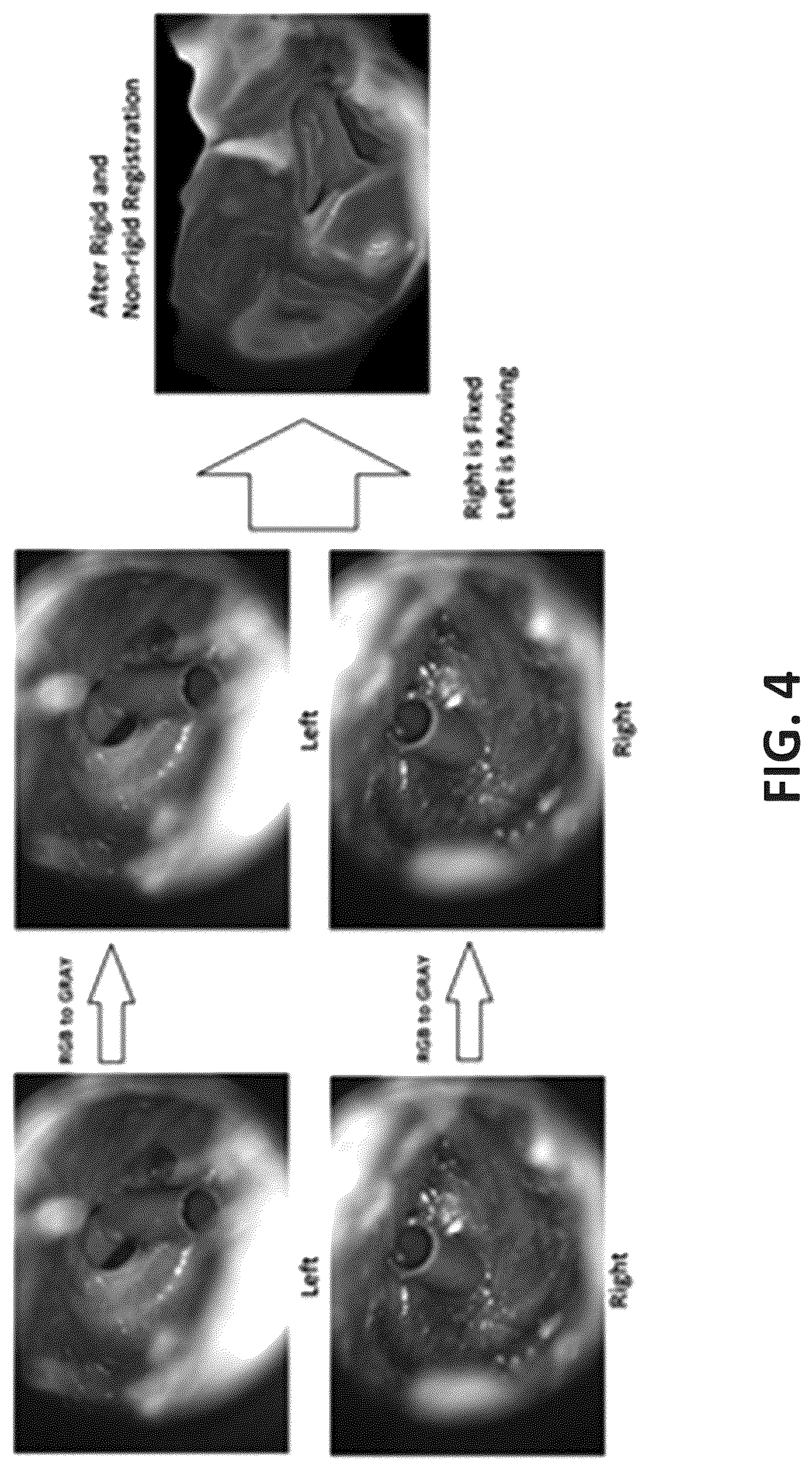 Patent US12315143 Figure 5 – System and method of using right and left eardrum otoscopy images for automated otoscopy image analysis to diagnose ear pathology