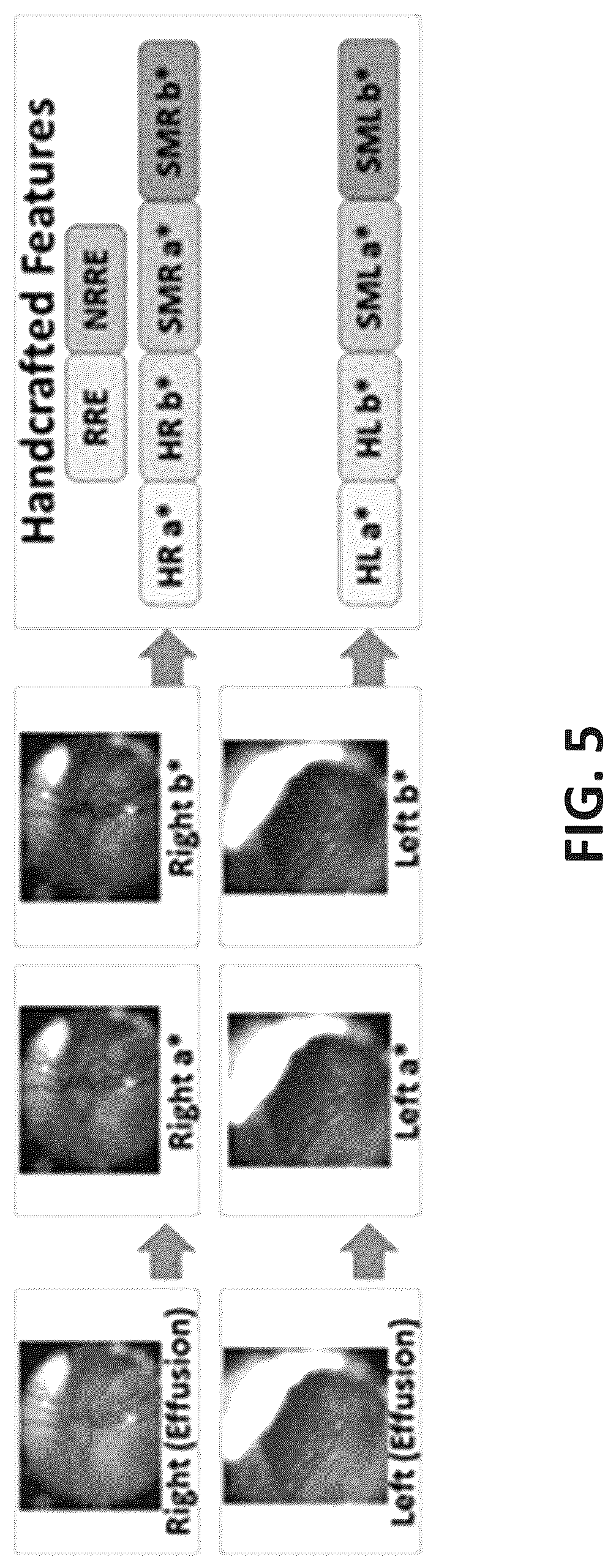Patent US12315143 Figure 6 – System and method of using right and left eardrum otoscopy images for automated otoscopy image analysis to diagnose ear pathology