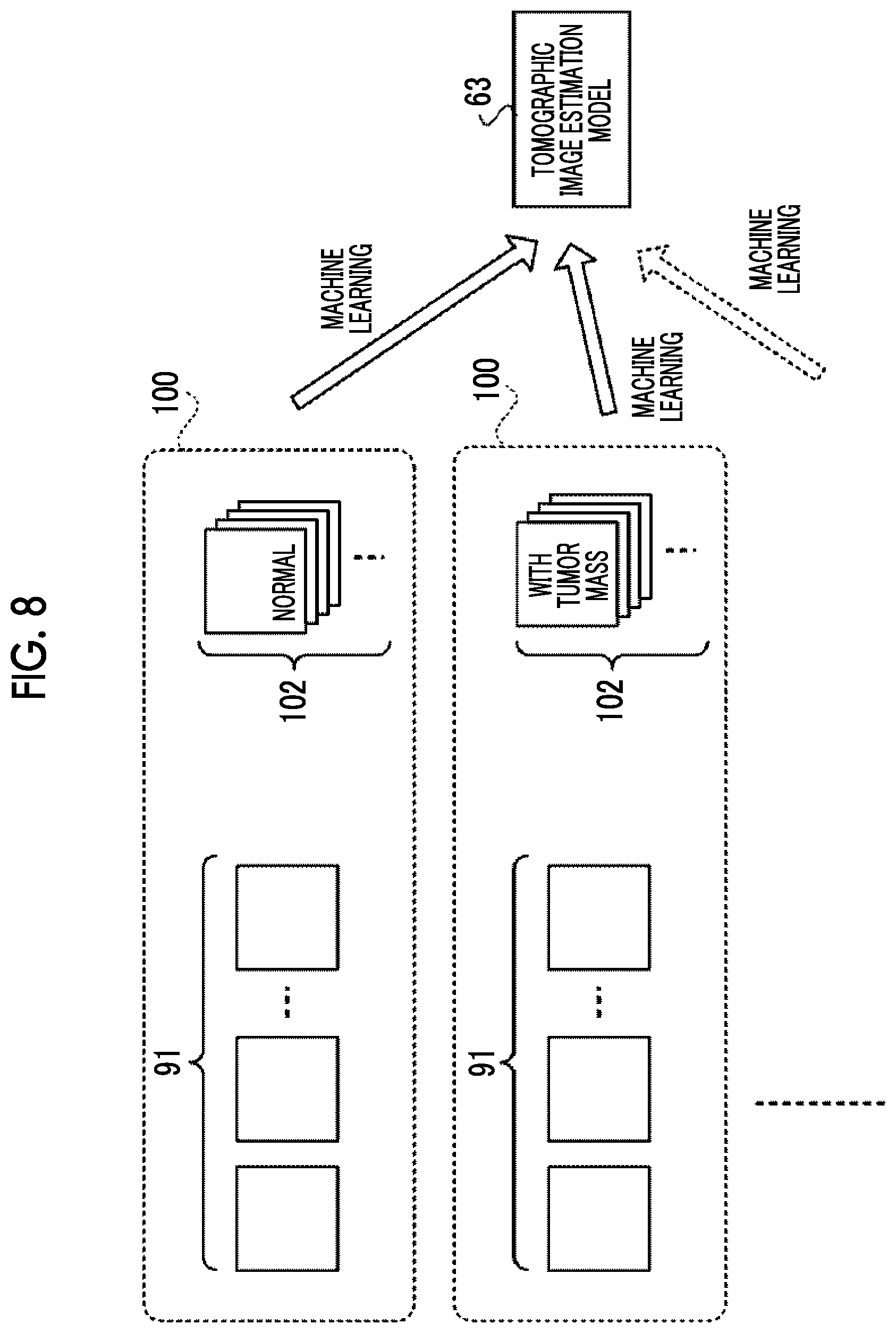 Patent US12315145 Figure 5 – Image processing device, learning device, radiography system, image processing method, learning method, image processing program, and learning program