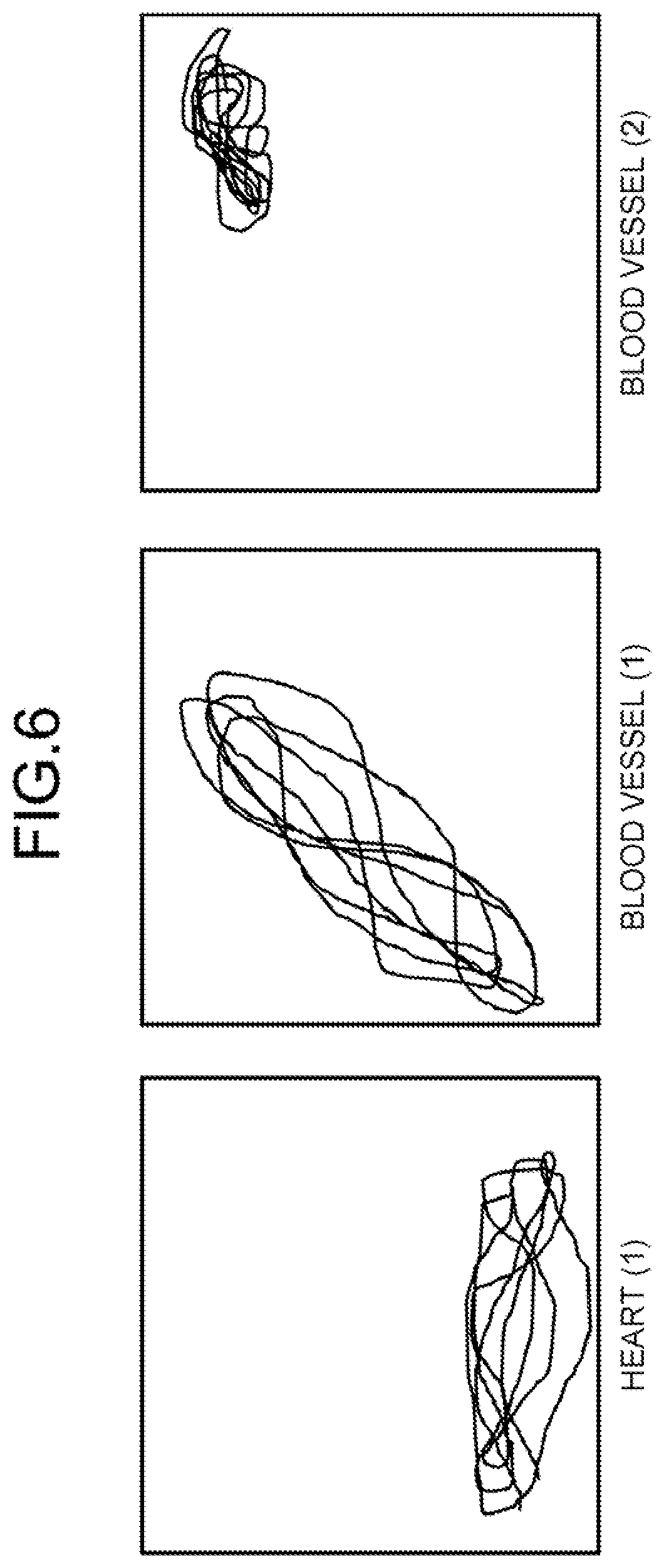 Patent US12315146 Figure 6 – Calculation method, calculation device, and computer-readable recording medium