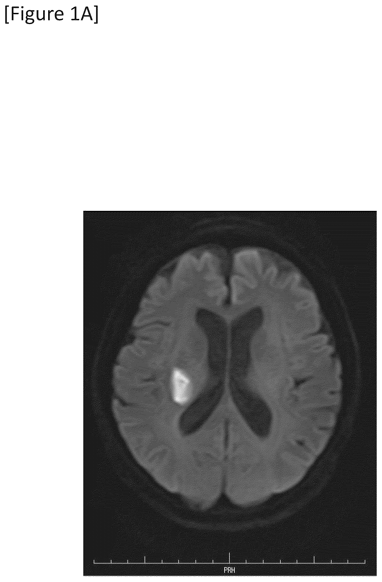 Patent US12315148 Figure 1 – Integrated system for safe intracranial administration of cells