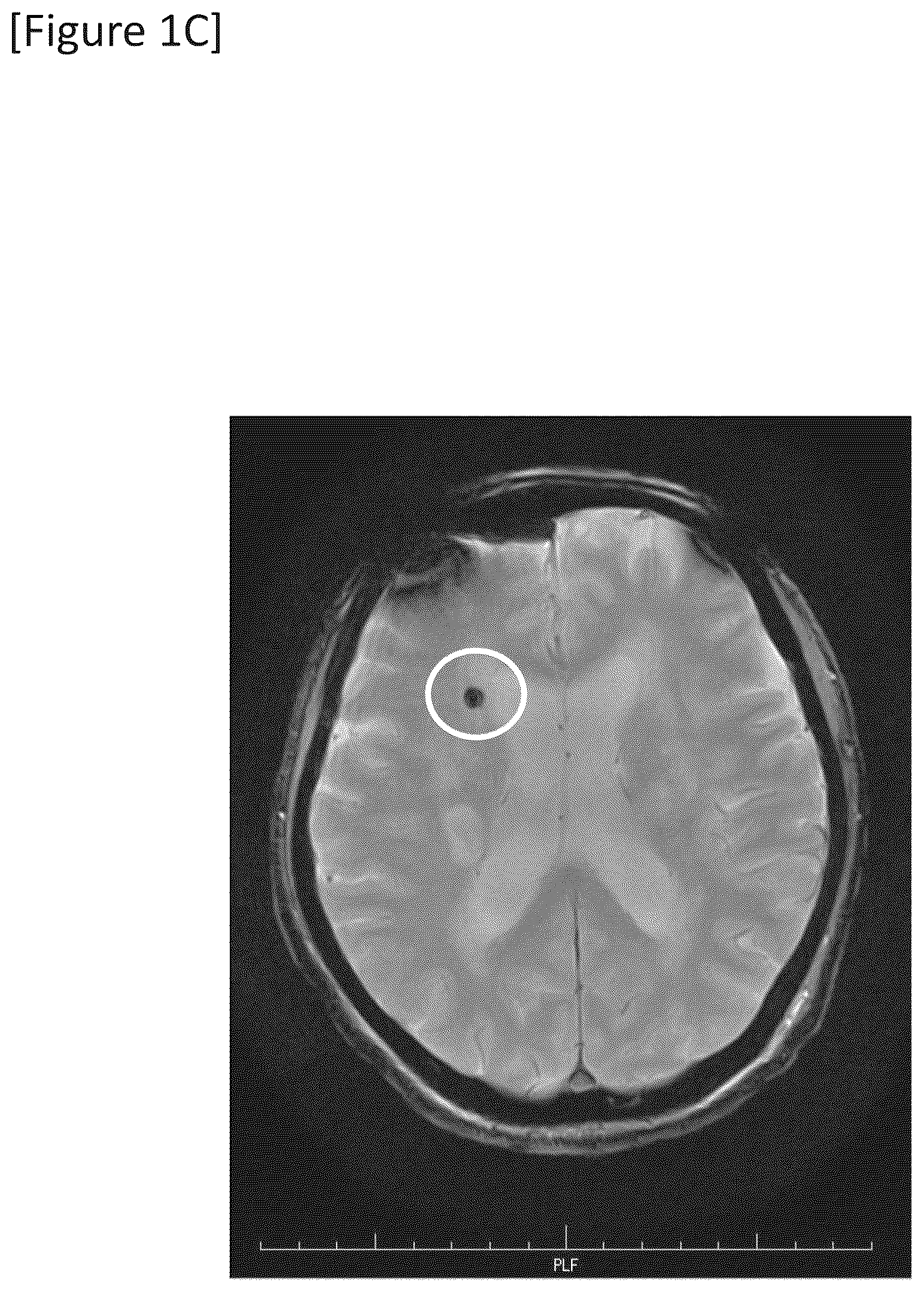 Patent US12315148 Figure 3 – Integrated system for safe intracranial administration of cells