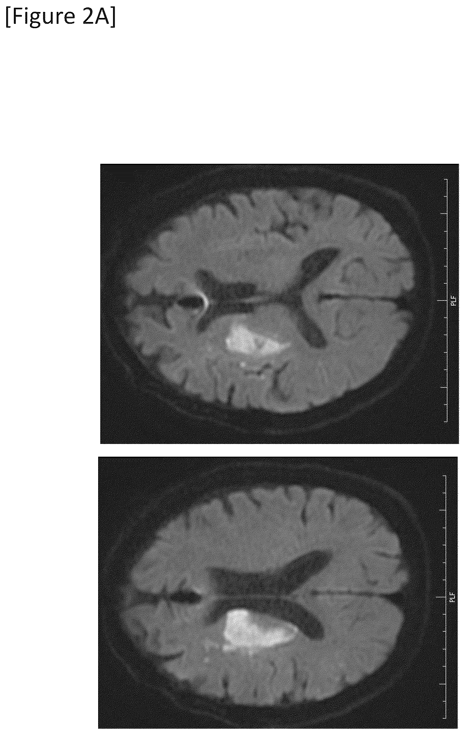 Patent US12315148 Figure 4 – Integrated system for safe intracranial administration of cells