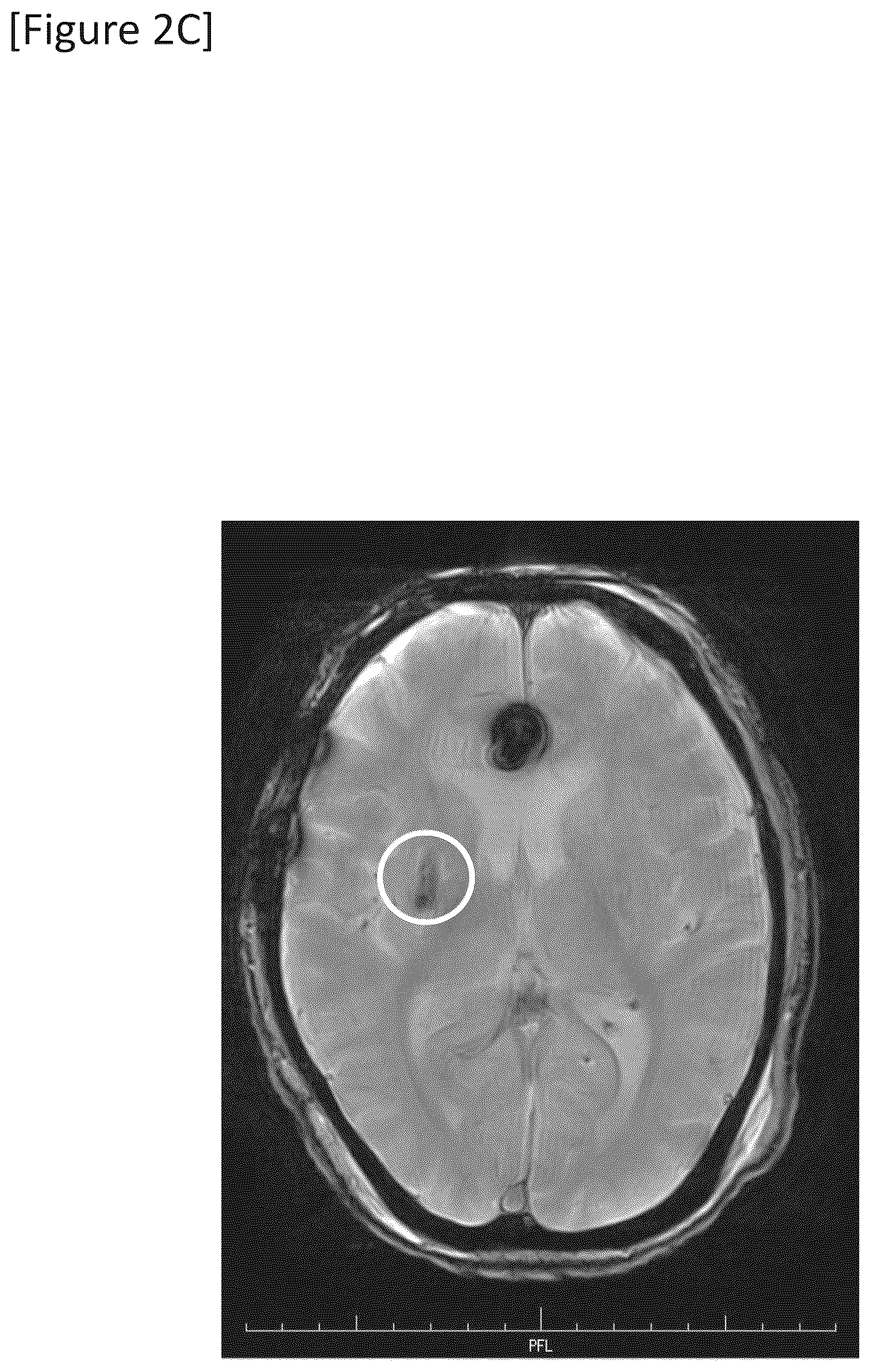 Patent US12315148 Figure 6 – Integrated system for safe intracranial administration of cells
