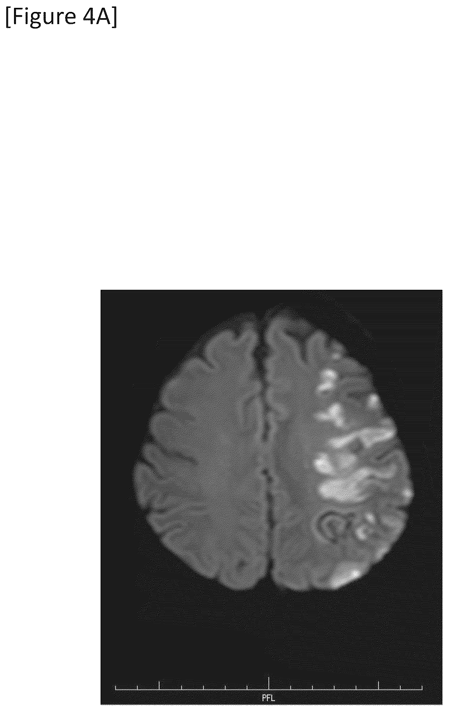 Patent US12315148 Figure 10 – Integrated system for safe intracranial administration of cells