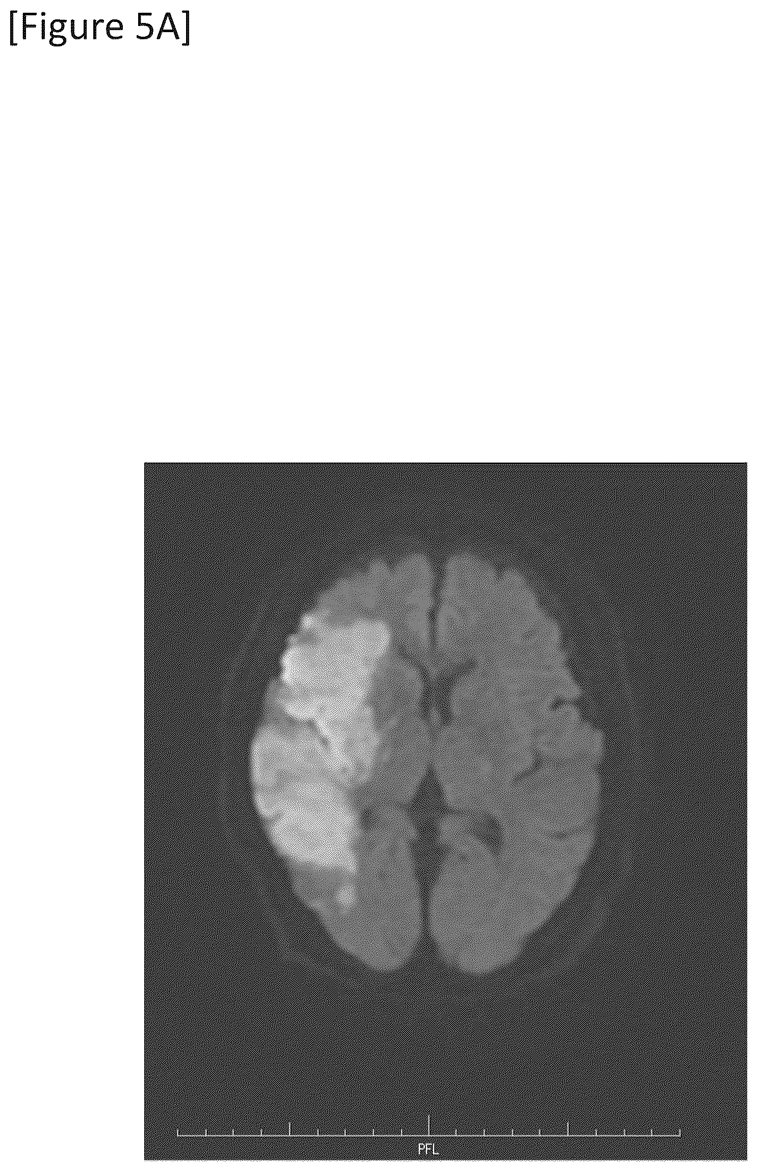 Patent US12315148 Figure 13 – Integrated system for safe intracranial administration of cells