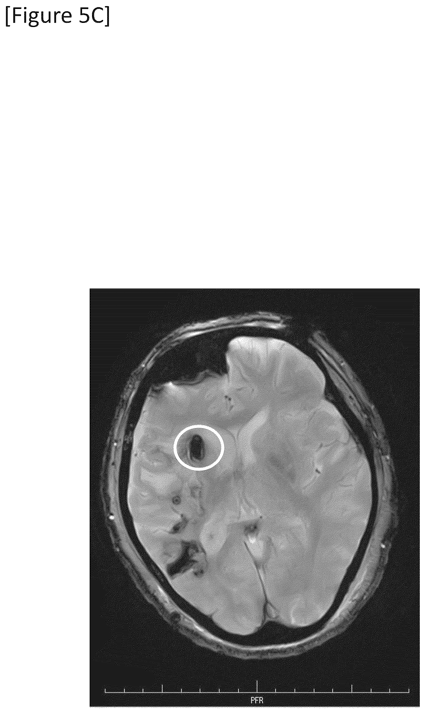 Patent US12315148 Figure 15 – Integrated system for safe intracranial administration of cells