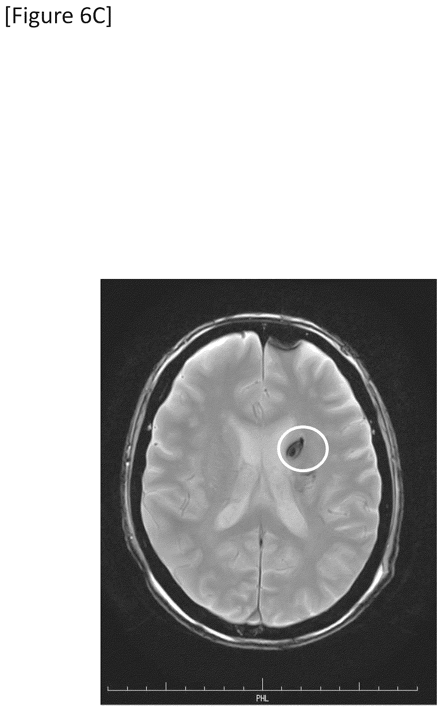 Patent US12315148 Figure 18 – Integrated system for safe intracranial administration of cells