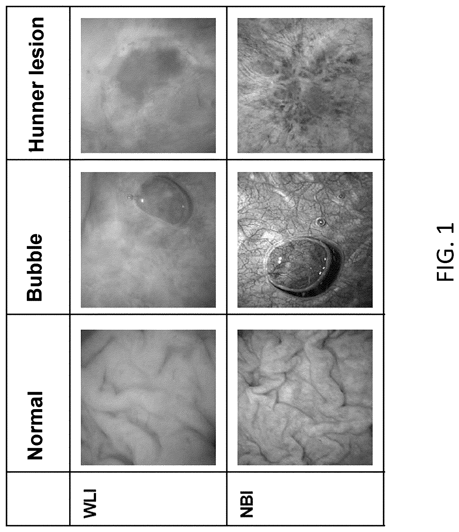 Patent US12315150 Figure 1 – Program for indicating Hunner lesion, learned model, and method for generating same