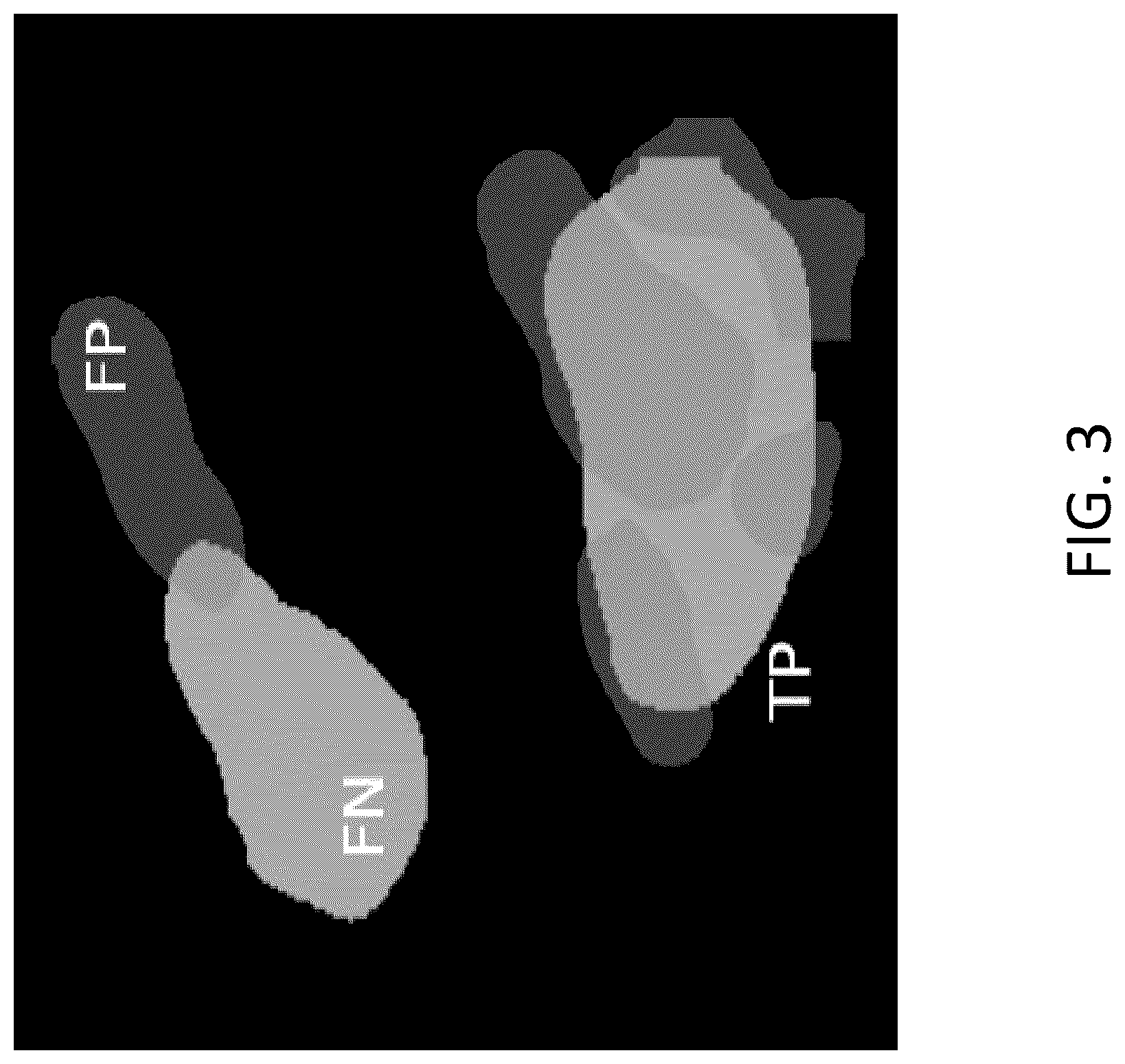 Patent US12315150 Figure 3 – Program for indicating Hunner lesion, learned model, and method for generating same