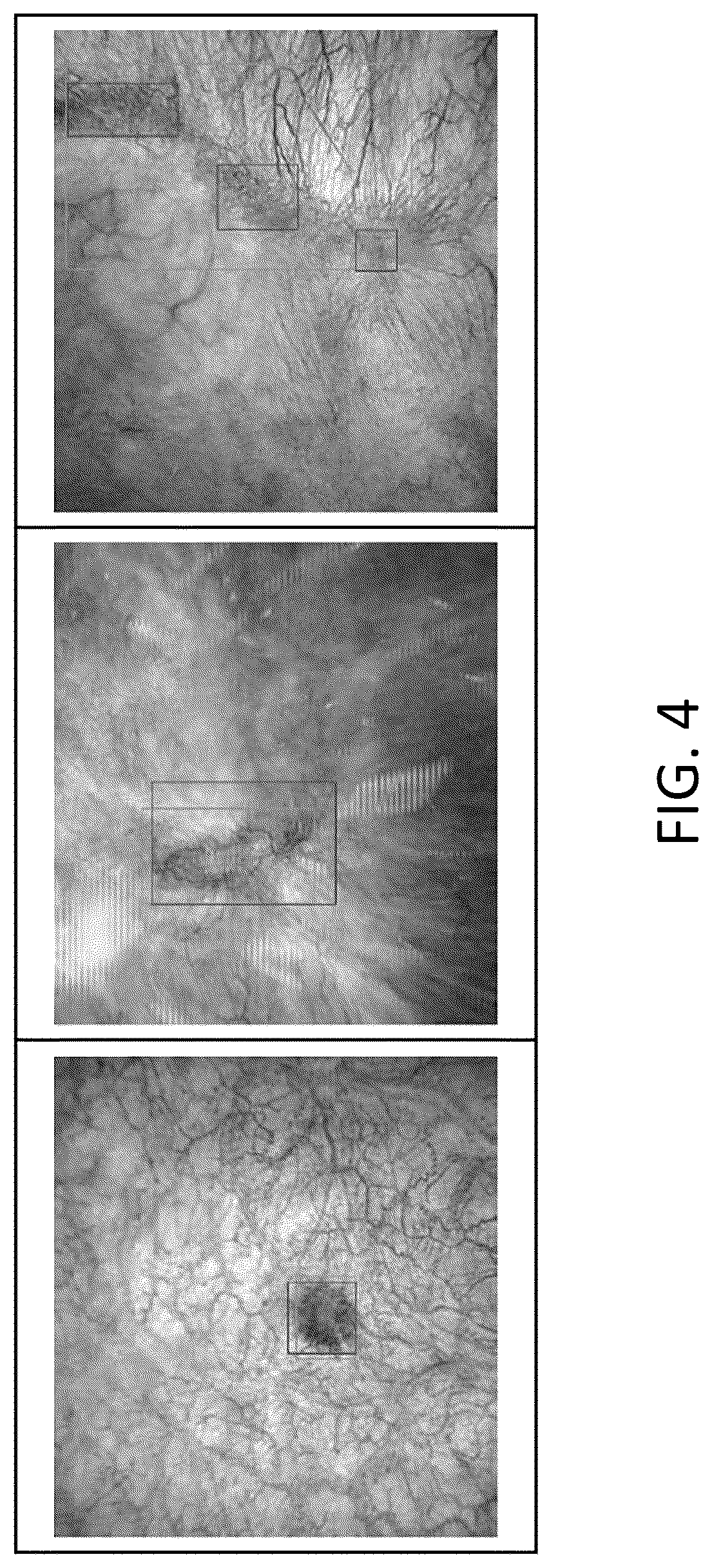 Patent US12315150 Figure 4 – Program for indicating Hunner lesion, learned model, and method for generating same