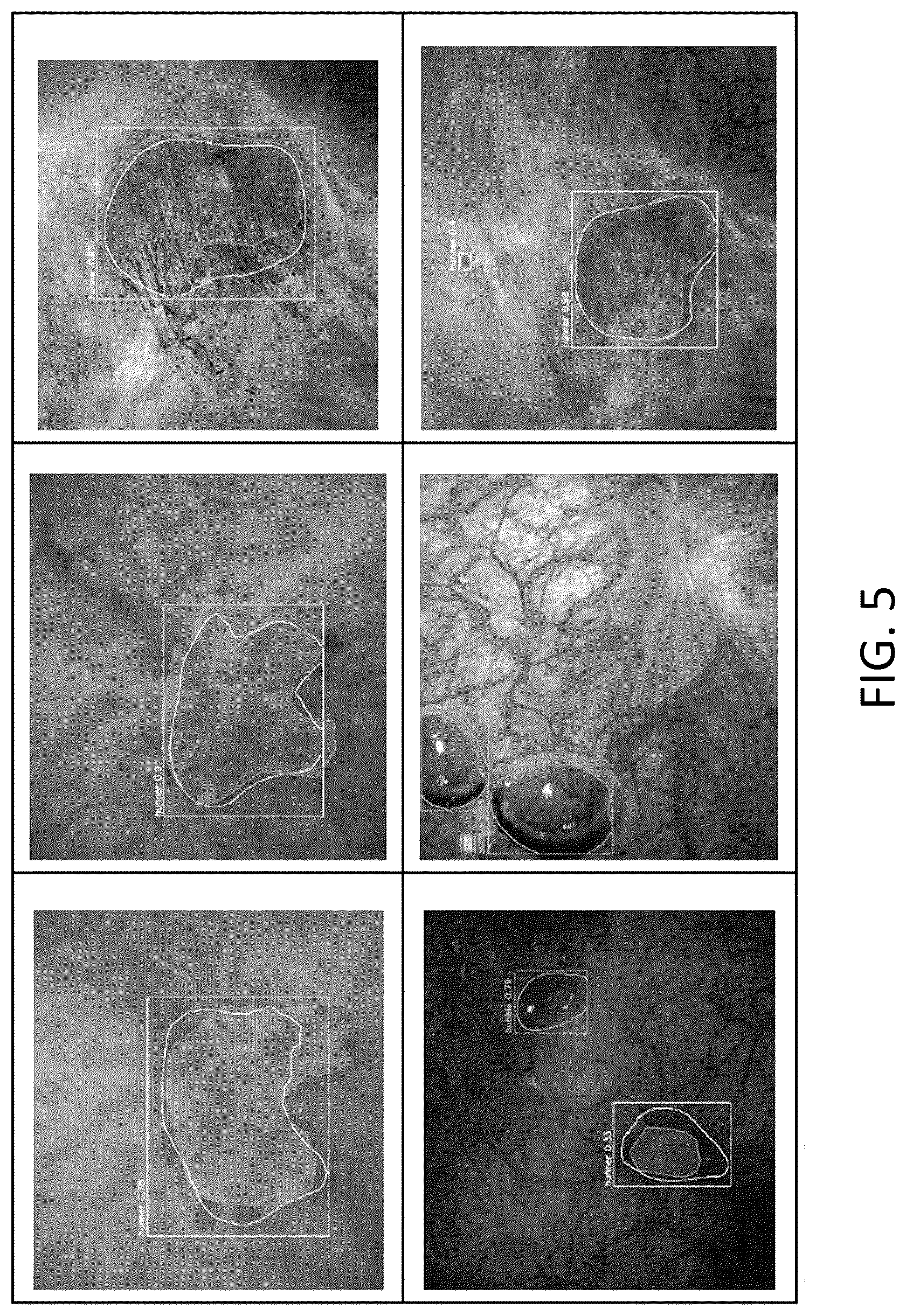 Patent US12315150 Figure 5 – Program for indicating Hunner lesion, learned model, and method for generating same