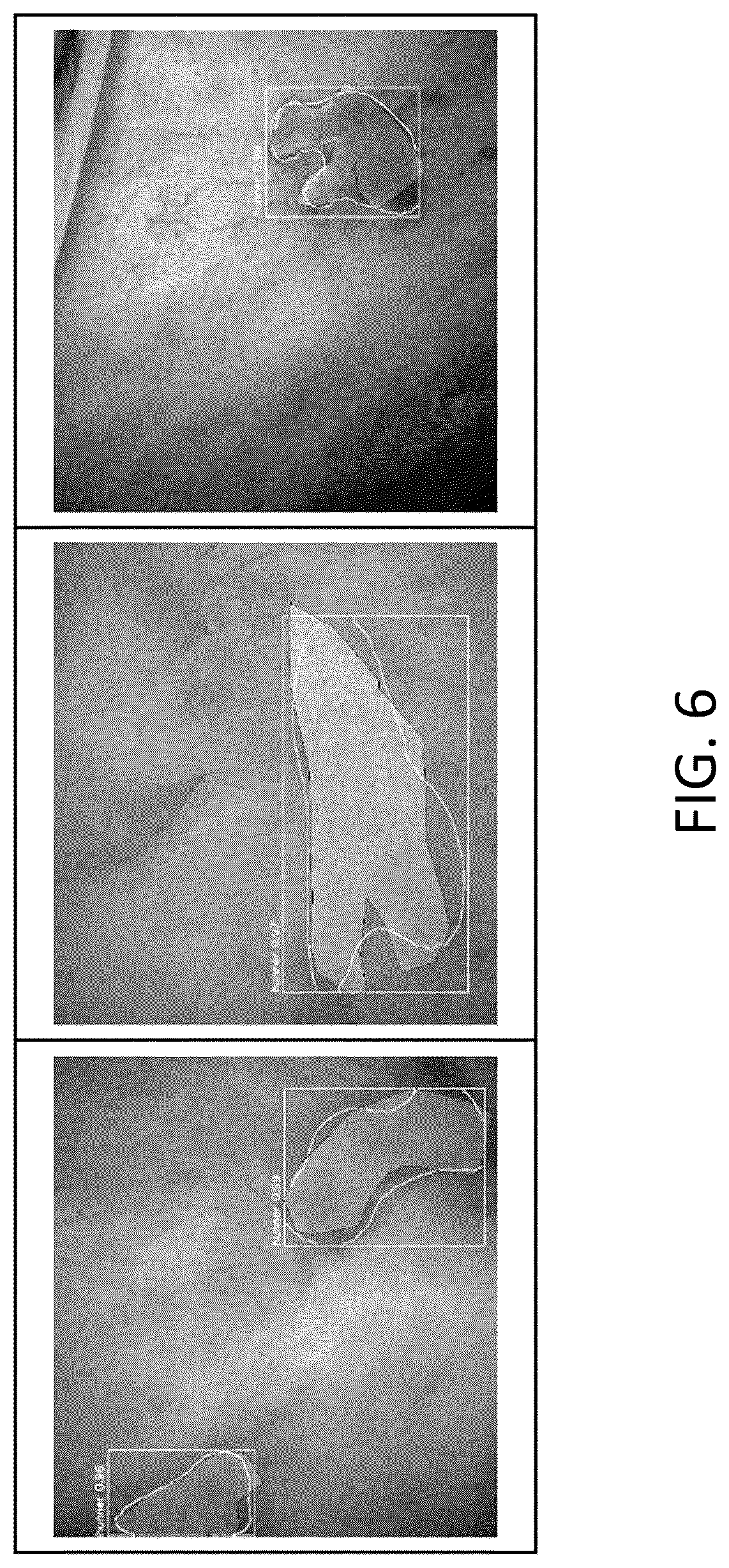 Patent US12315150 Figure 6 – Program for indicating Hunner lesion, learned model, and method for generating same