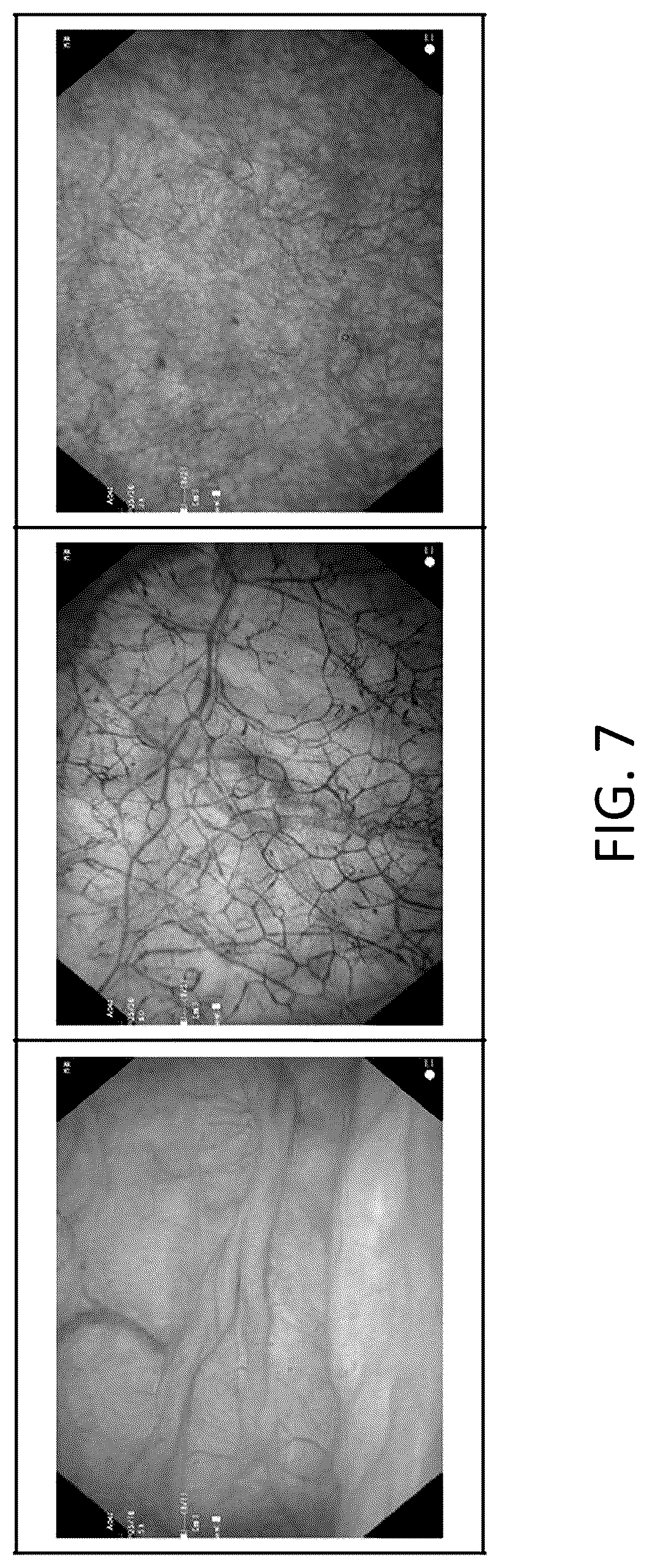 Patent US12315150 Figure 7 – Program for indicating Hunner lesion, learned model, and method for generating same