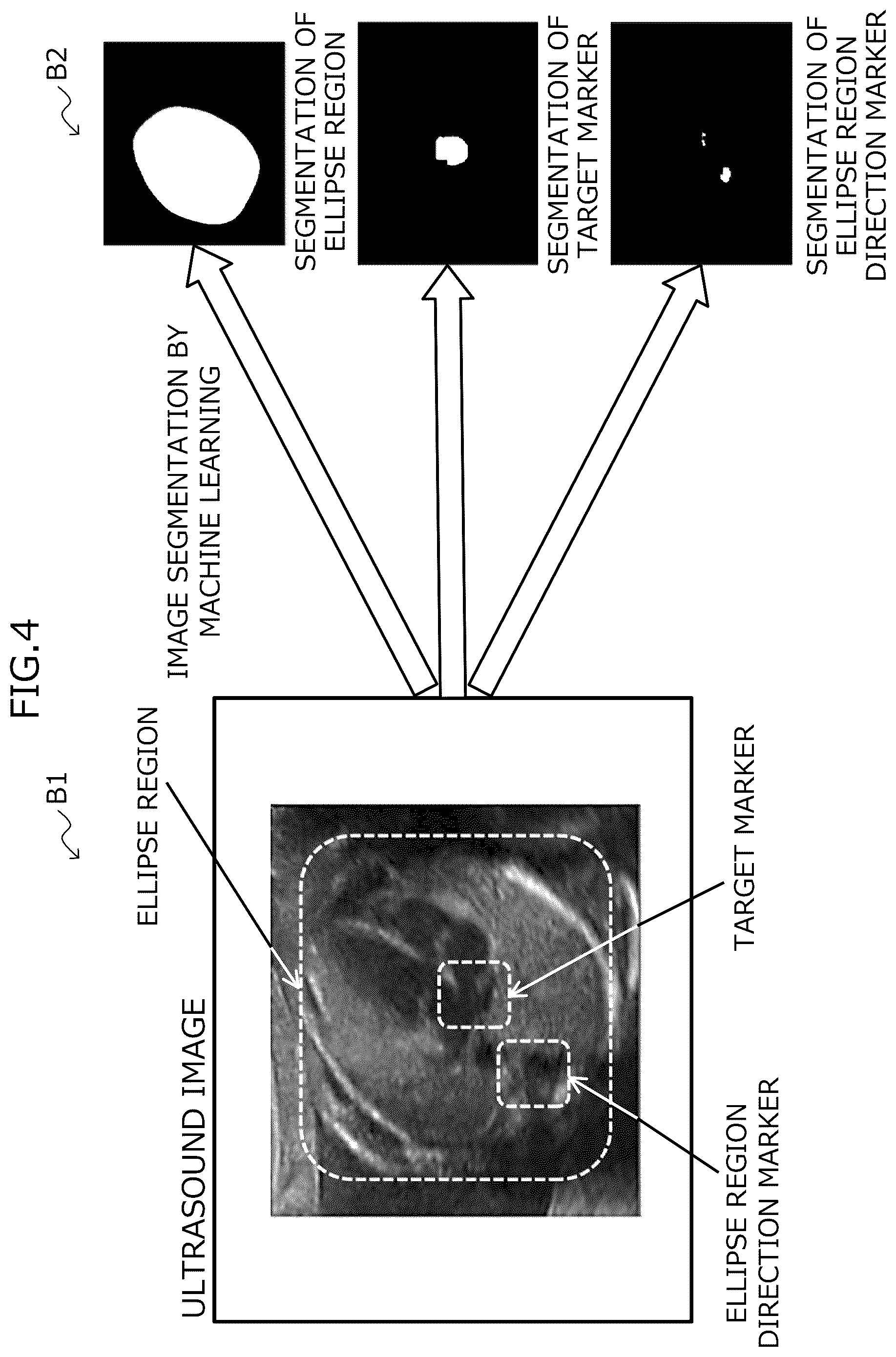 Patent US12315151 Figure 4 – Computer-readable recording medium having stored therein information processing program, information processing apparatus, and method for processing information
