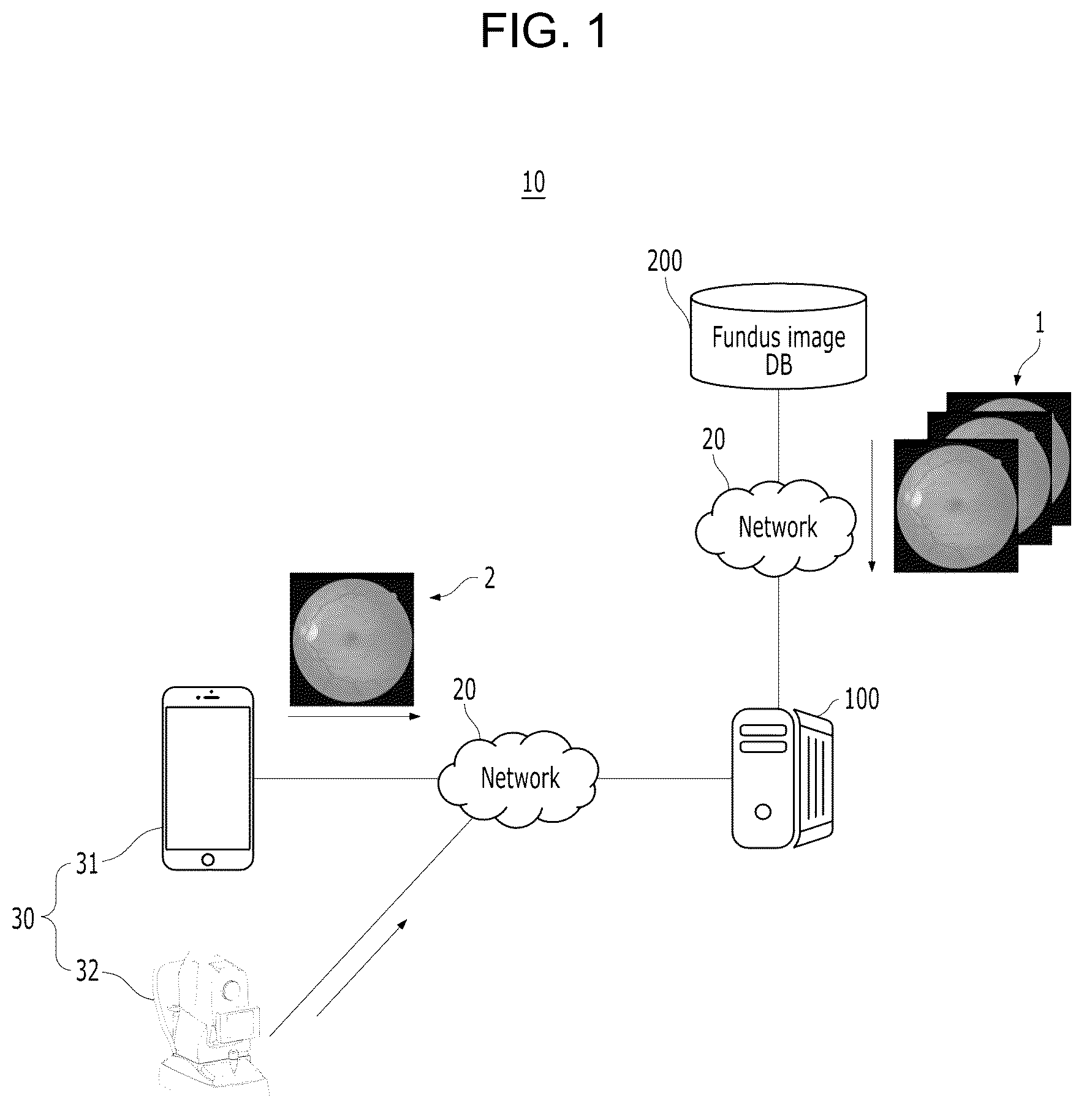 Patent US12315153 Figure 1 – Apparatus and method for predicting biometrics based on fundus image