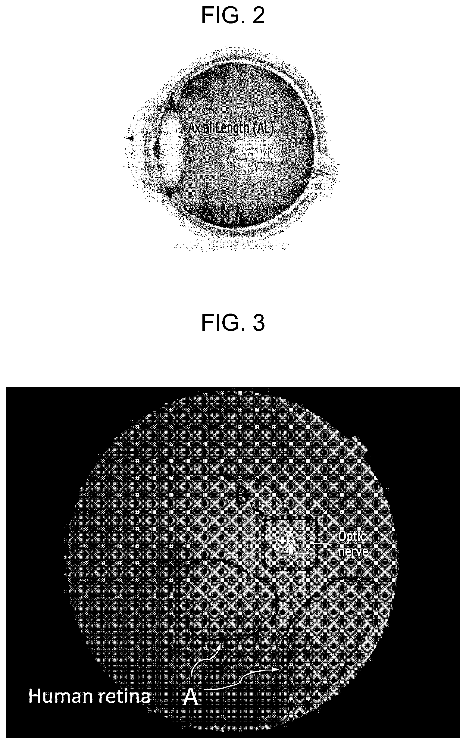 Patent US12315153 Figure 2 – Apparatus and method for predicting biometrics based on fundus image