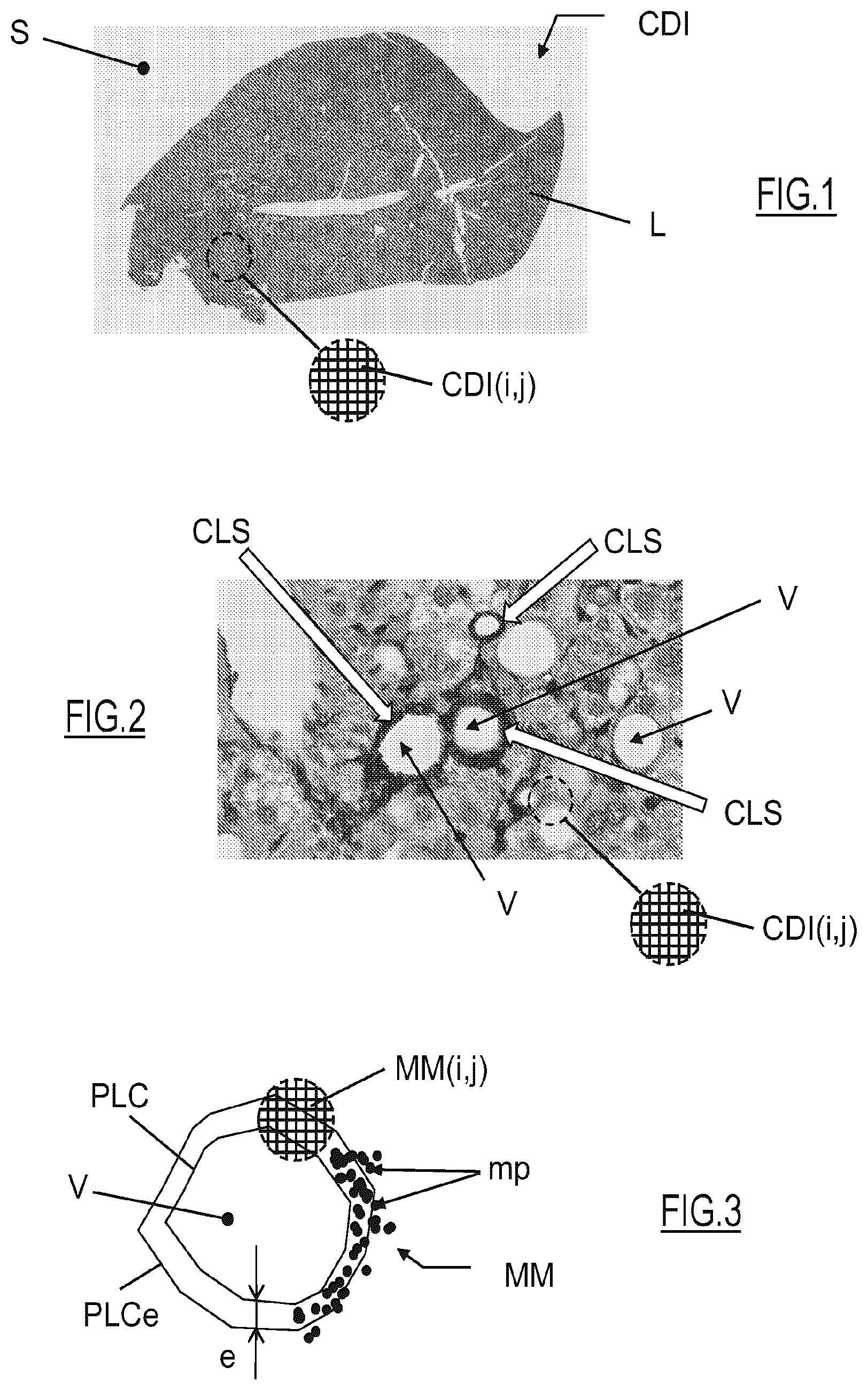 Patent US12315154 Figure 1 – System and method for generating an indicator from an image of a histological section