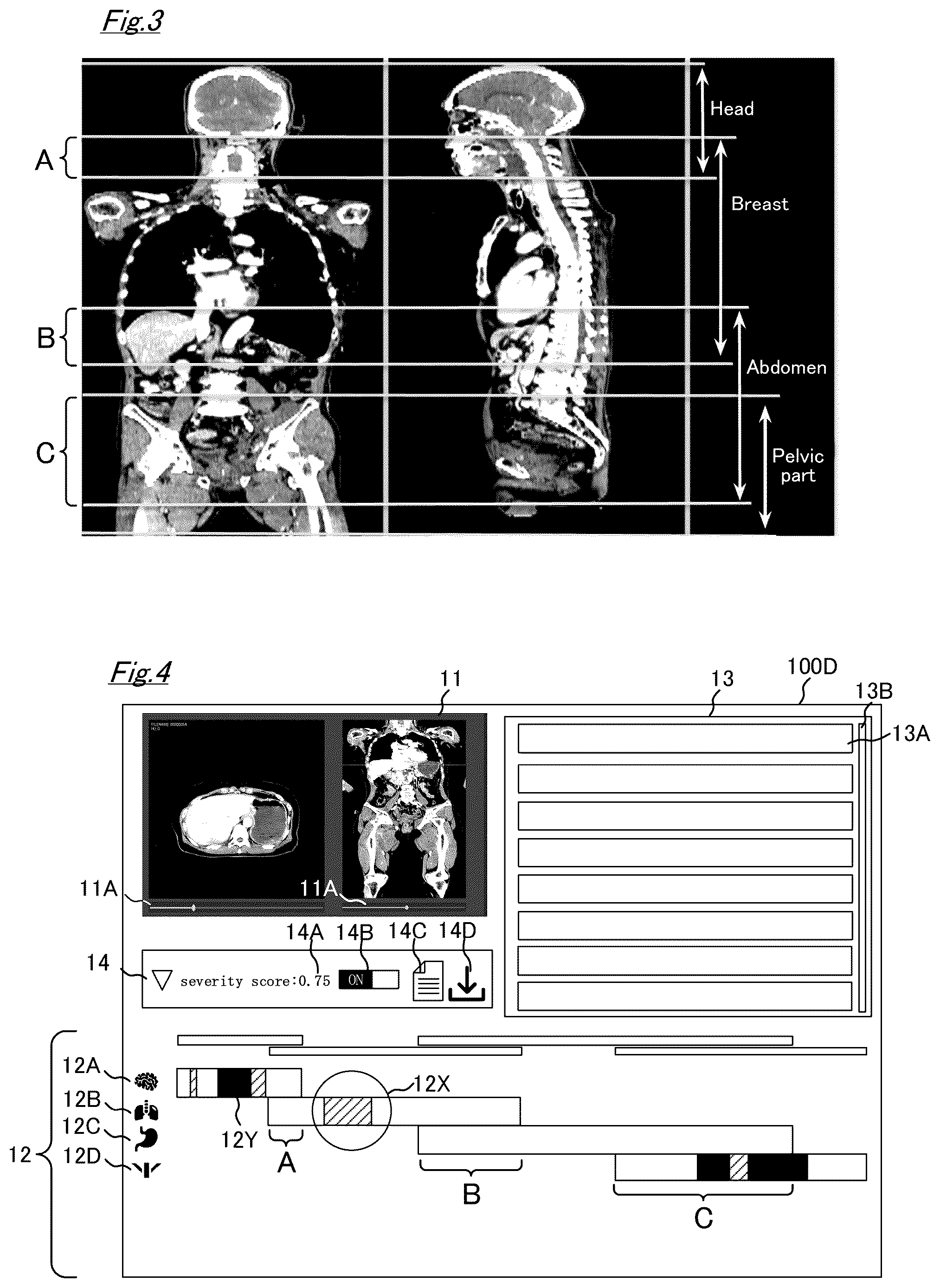 Patent US12315155 Figure 2 – Information processing apparatus, information processing method, information processing program, and information processing system