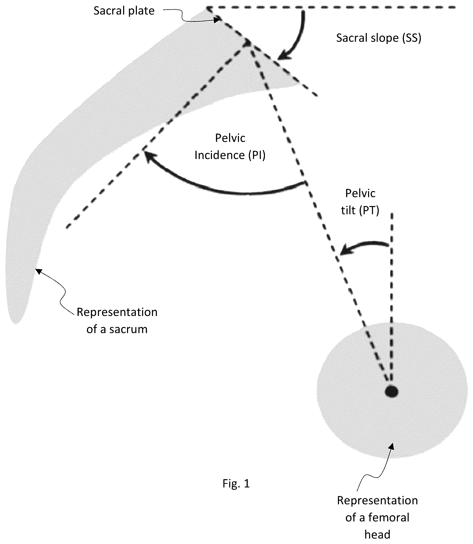Patent US12315157 — System and method for patient-specific anatomical analyses — Figure 1