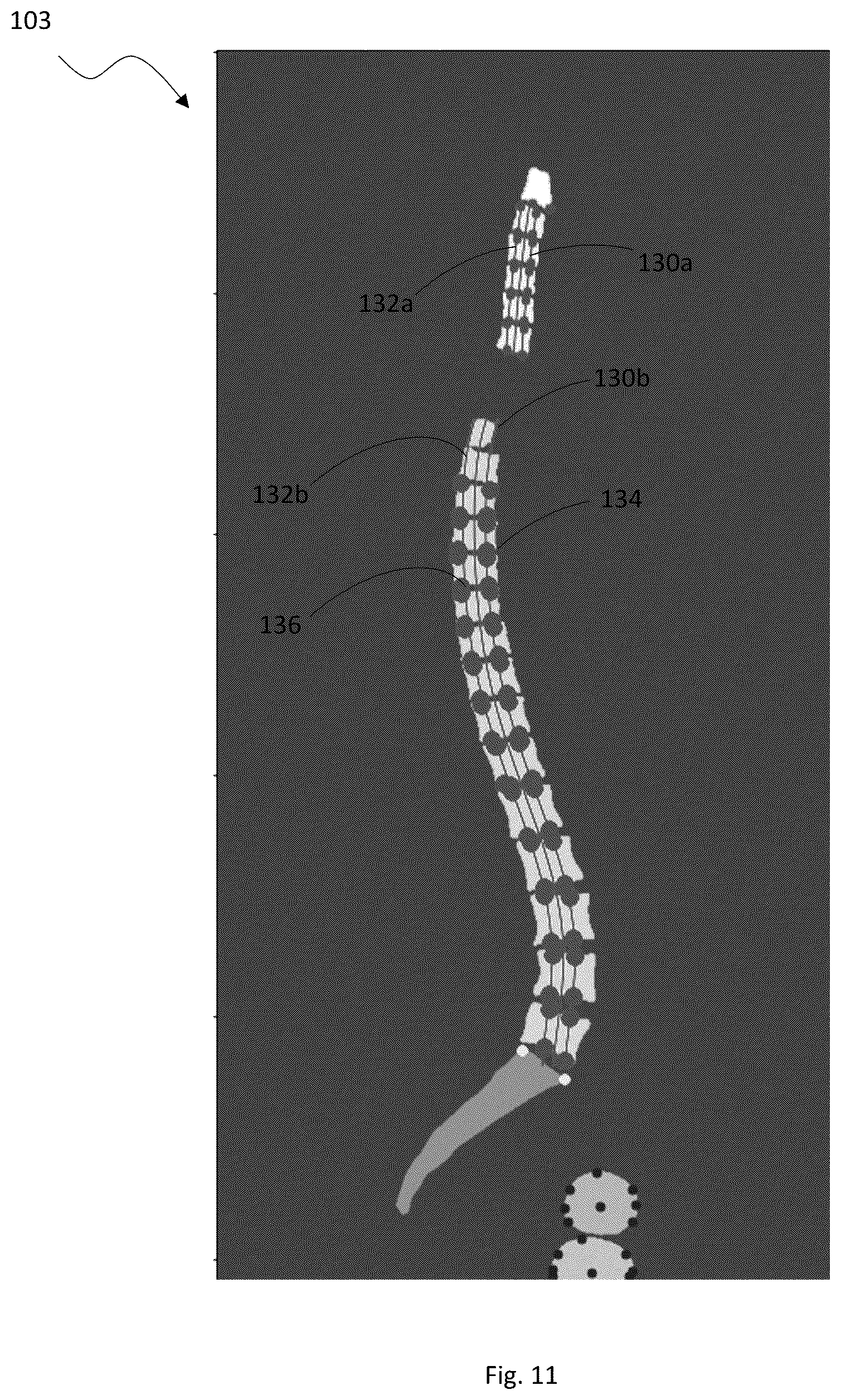 Patent US12315157 Figure 11 – System and method for patient-specific anatomical analyses