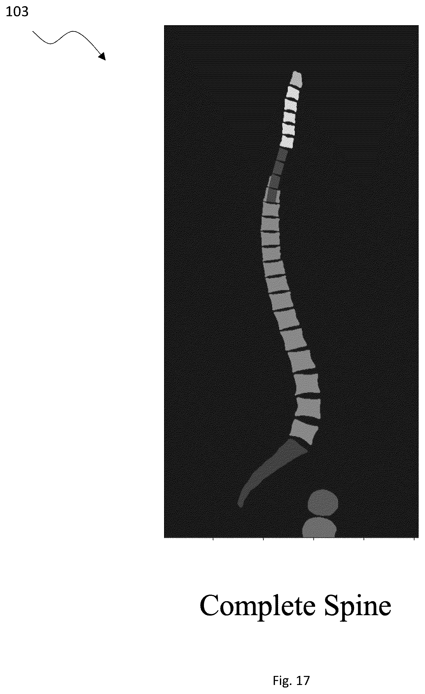 Patent US12315157 Figure 17 – System and method for patient-specific anatomical analyses