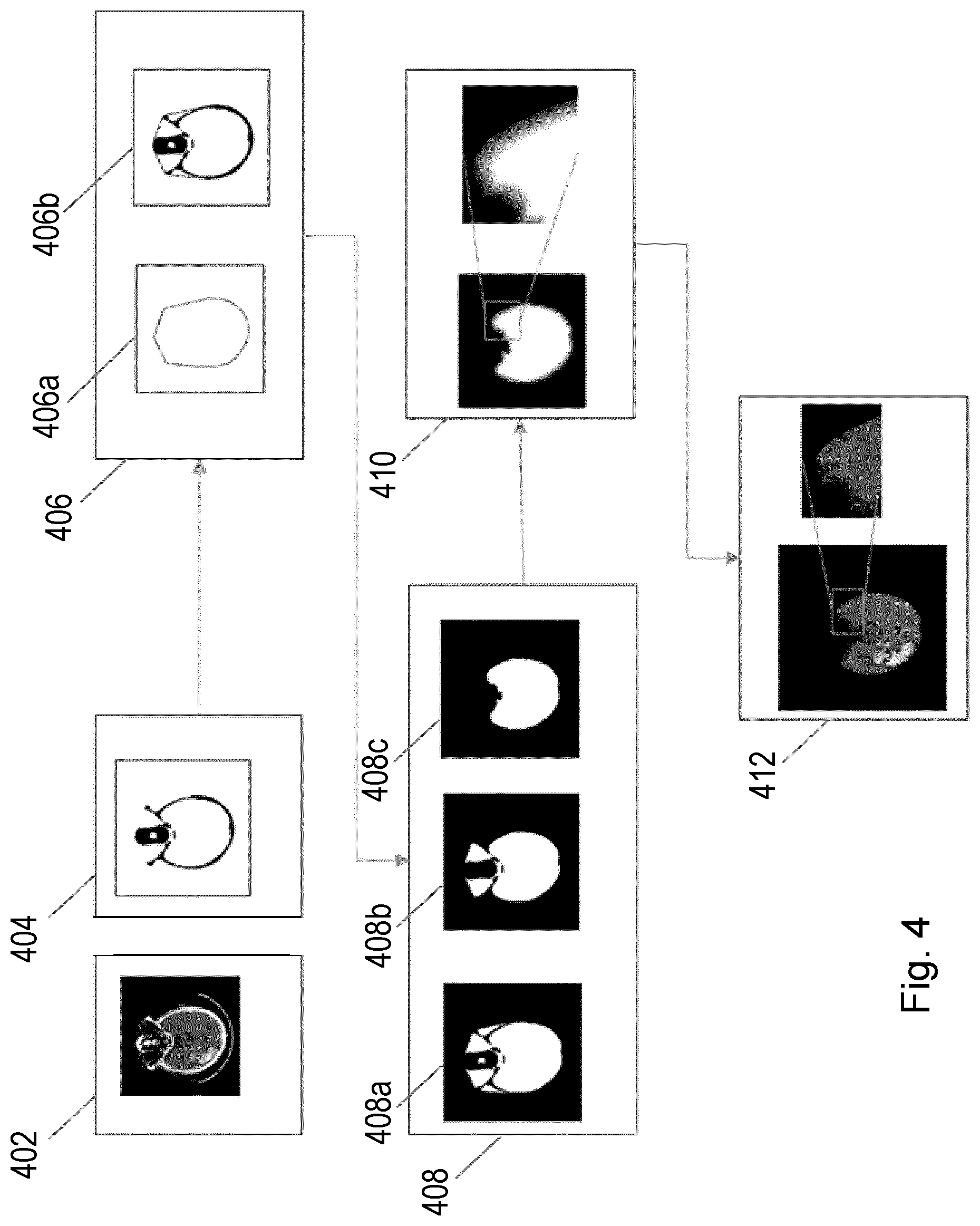 Patent US12315159 Figure 4 – Image processing for stroke characterization